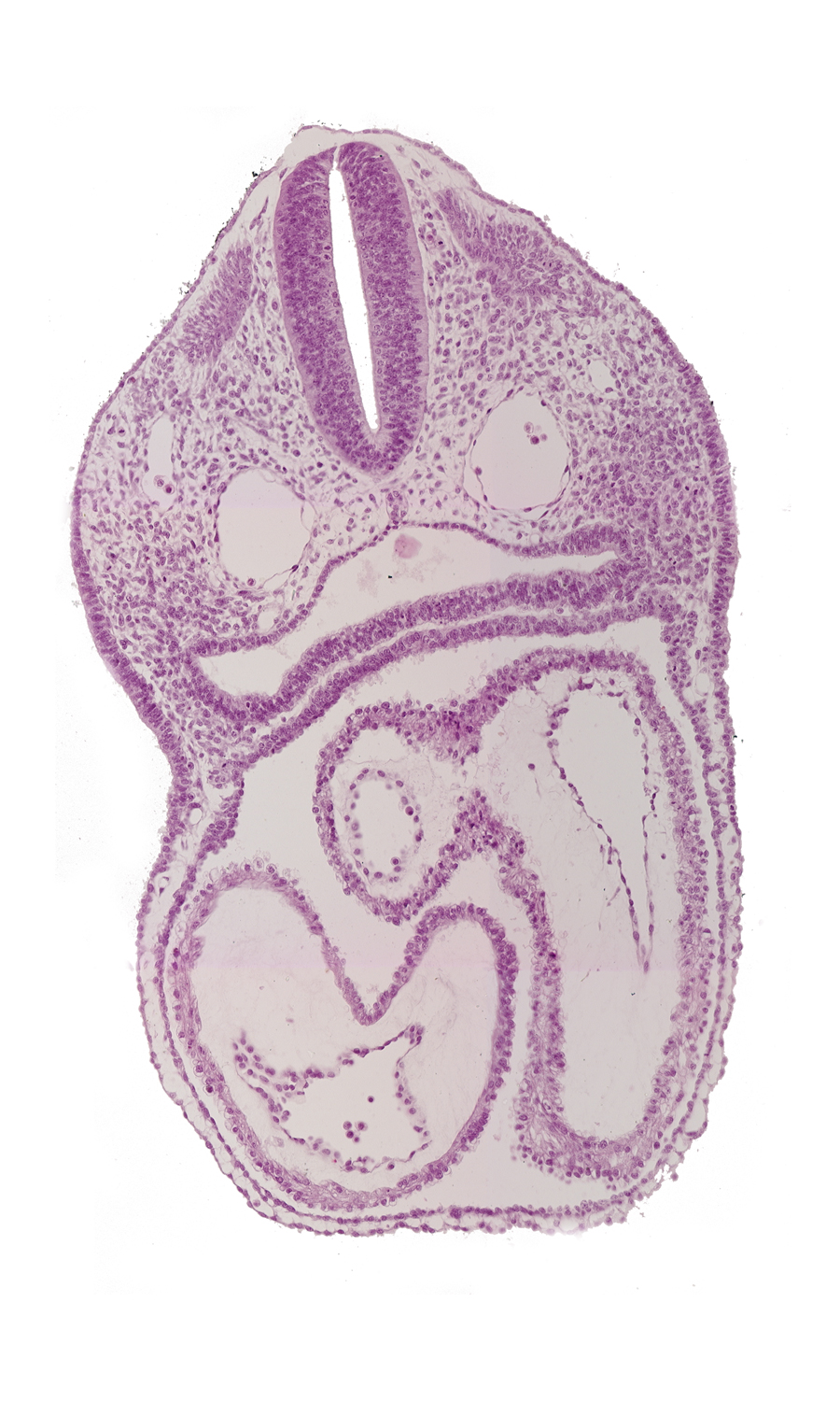 atrioventricular canal, cardiac jelly, conus cordis, dermatomyotome 3 (O-3) , dorsal aorta, ectodermal ring, endocardium, epimyocardium, floor of interatrial sulcus, left atrium, left ventricle, notochord, pericardial cavity, pharyngeal pouch 4, pharynx, precardinal vein, rhombencephalon (Rh. D), right atrium, sclerotome, truncus arteriosus