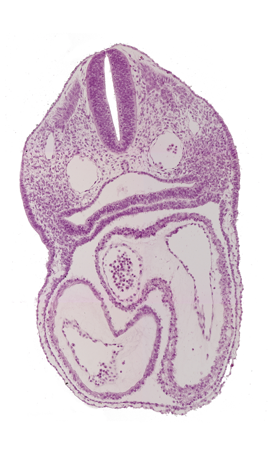 atrioventricular canal, conus cordis, dermatomyotome 3 (O-3) , interatrial sulcus, left atrium, left ventricle, notochord, pharyngeal pouch 4, precardinal vein, right atrium, sclerotome, sulcus limitans