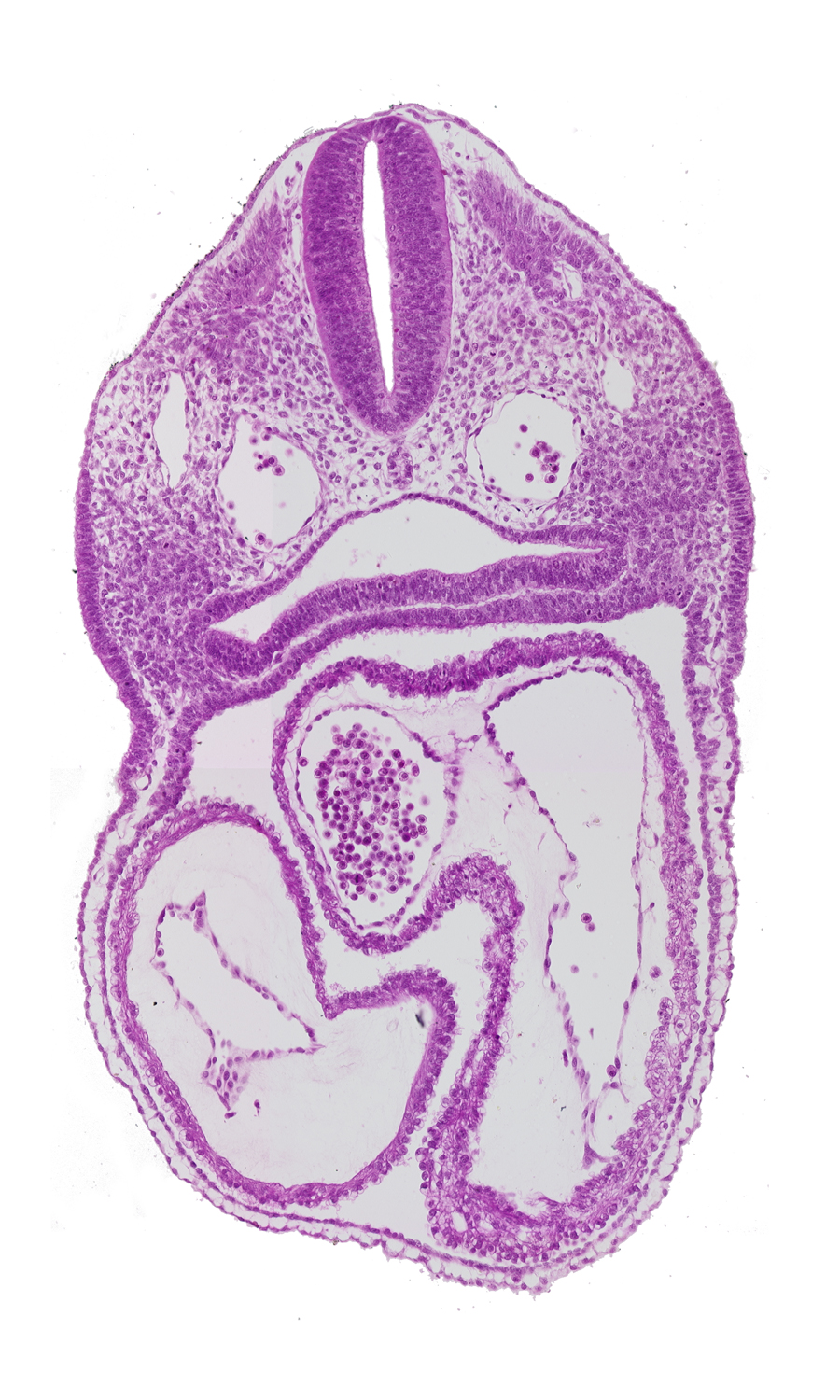 atrioventricular canal, cephalic edge of primary interatrial septum (septum primum), conus cordis, dermatomyotome 3 (O-3) , dorsal aorta, interatrial sulcus, left atrium, left ventricle, notochord, pharyngeal pouch 4, pharynx, precardinal vein, rhombencephalon (Rh. D), right atrium, sclerotome, somitocoel, sulcus limitans