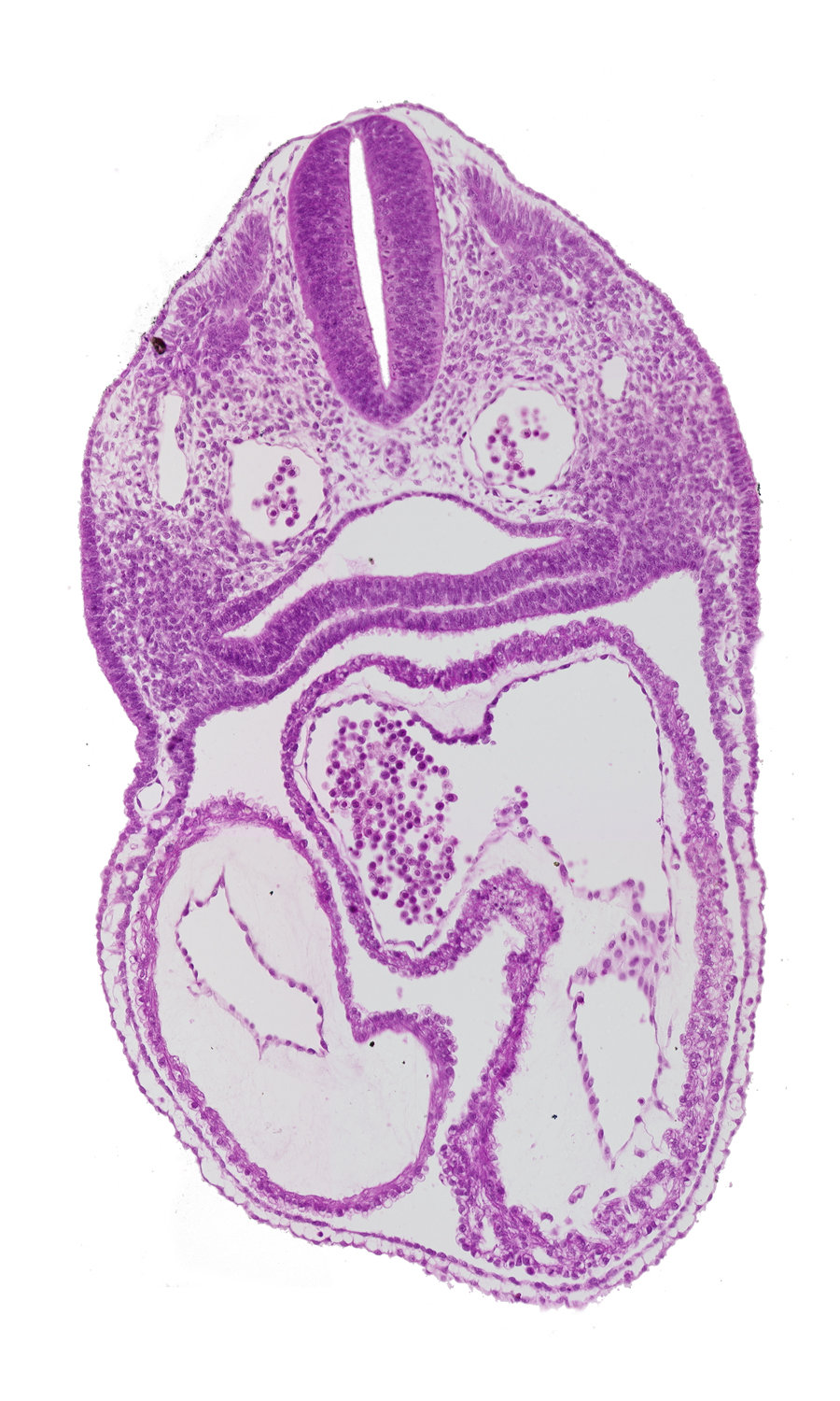 cardiac jelly, conus cordis, dermatomyotome 3 (O-3) , dorsal aorta, ectoderm, interatrial foramen (primum), interatrial sulcus, junction of conus cordis and right ventricle, left atrium, left ventricle, mesoderm, notochord, pericardial cavity, pharynx, primary interatrial septum (septum primum), rhombencephalon (Rh. D), right atrium