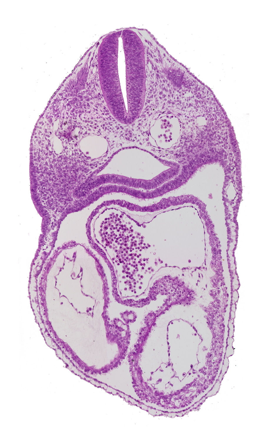 cardiac jelly, caudal part of dermatomyotome 3 (O-3), dorsal aorta, endocardium, epimyocardium, interatrial foramen (primum), left atrium, left ventricle, pharynx, precardinal vein, right atrium, right ventricle, ultimopharyngeal pouch
