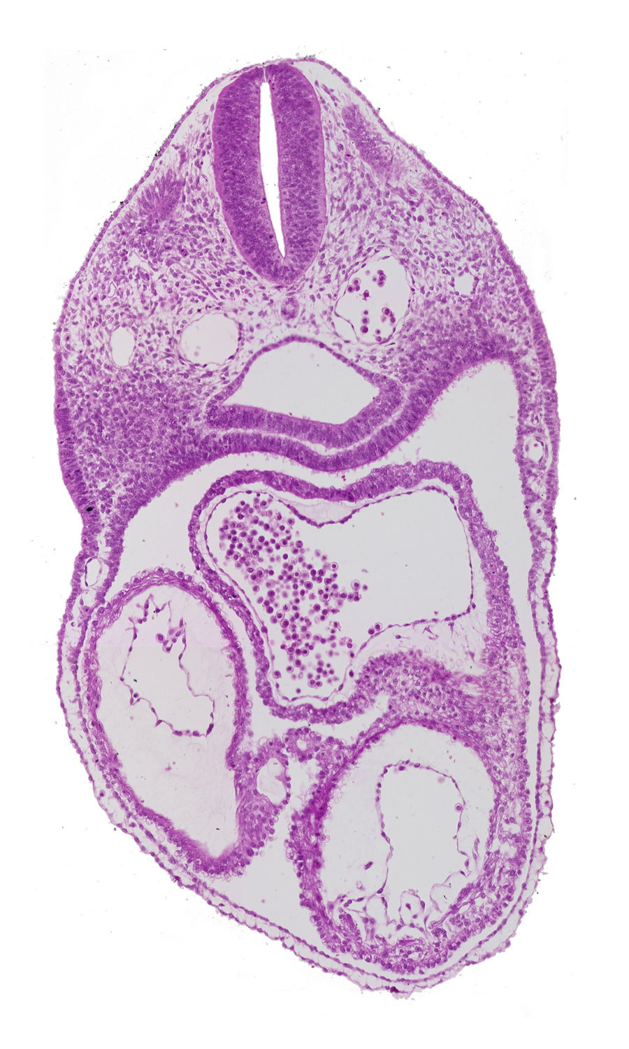cephalic part of dermatomyotome 4 (O-4), dorsal aorta, interatrial foramen (primum), left atrium, left ventricle, origin of dorsal intersegmental artery, pericardial cavity, perinotochordal lamina, pharynx, precardinal vein, rhombencephalon (Rh. D), right atrium, right ventricle, ultimopharyngeal pouch