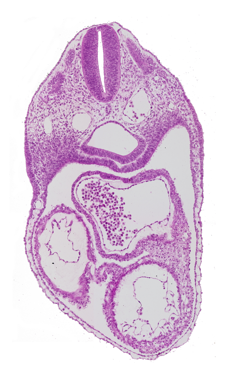 common atrium, dermatomyotome 4 (O-4) , ectodermal ring, left ventricle, pericardial cavity, rhombencephalon (Rh. D), rhombencoel (fourth ventricle), right ventricle, sclerotome, ultimopharyngeal pouch