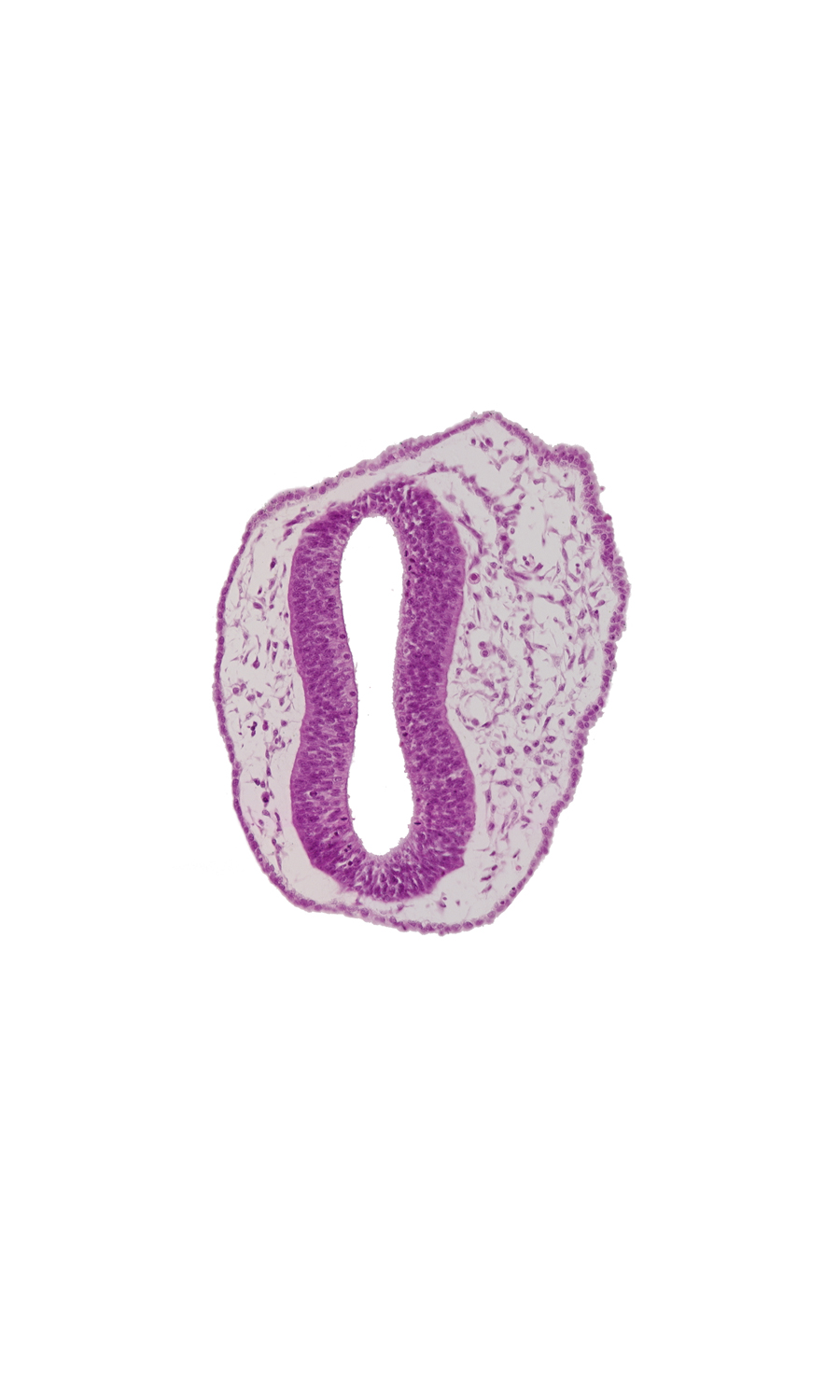 blood vessel(s), head mesenchyme, mesencephalon (M2), mesencoel, rhombencephalon (Rh. 1), rhombencoel (fourth ventricle), surface ectoderm