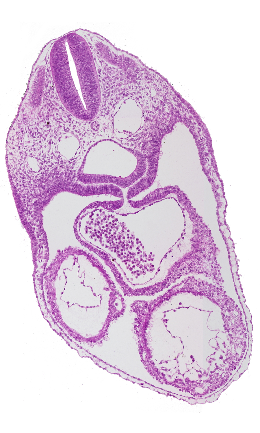 caudal end of pharynx, cephalic end of laryngotracheal groove, common atrium, dermatomyotome 4 (O-4) , left ventricle, mesocardium, pericardial cavity, rhombencephalon (Rh. D), rhombencoel (fourth ventricle), right ventricle, sclerotome, ultimopharyngeal pouch