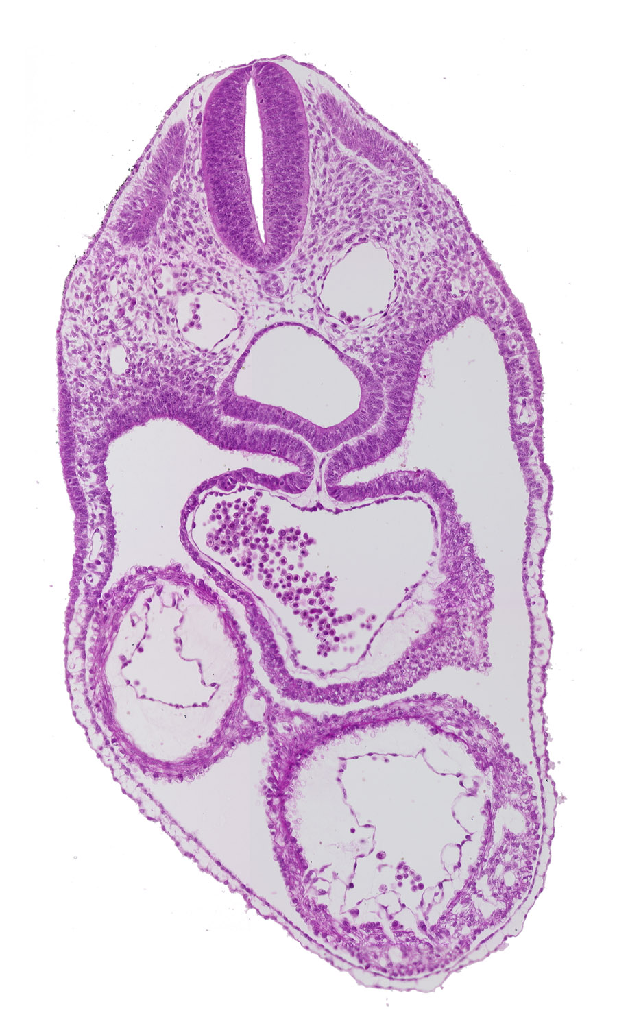 common atrium, dermatomyotome 4 (O-4) , dorsal aorta, ectodermal ring, foregut, laryngotracheal groove, mesocardium, pericardial cavity, precardinal vein, rhombencephalon (Rh. D)