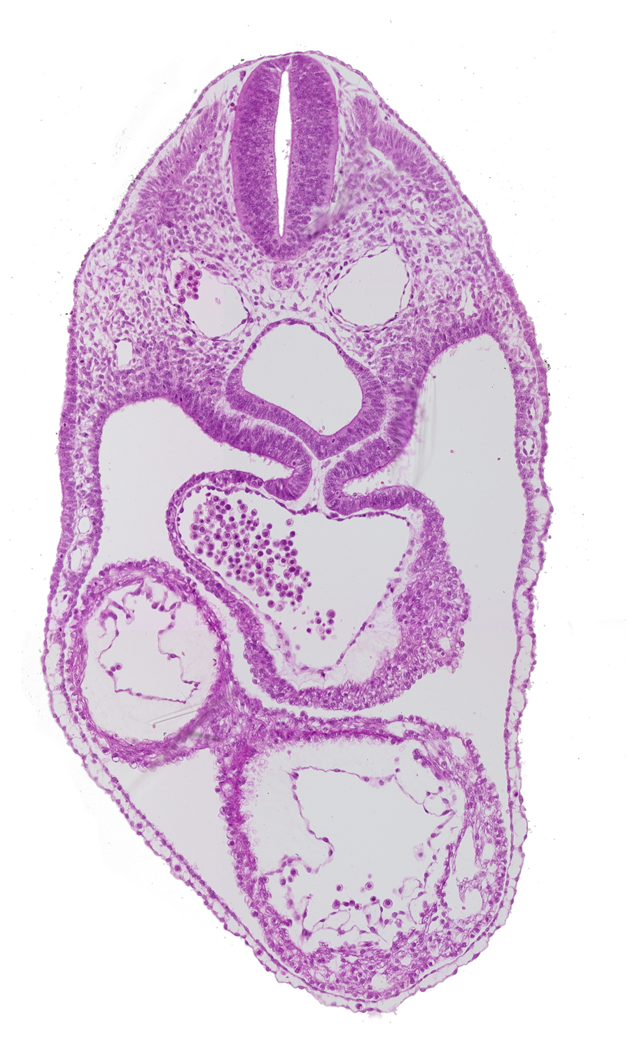 anterior interventricular sulcus, common atrium, dermatomyotome 4 (O-4) , dorsal aorta, foregut, laryngotracheal groove, left ventricle, mesoderm, precardinal vein, rhombencephalon (Rh. D), right ventricle
