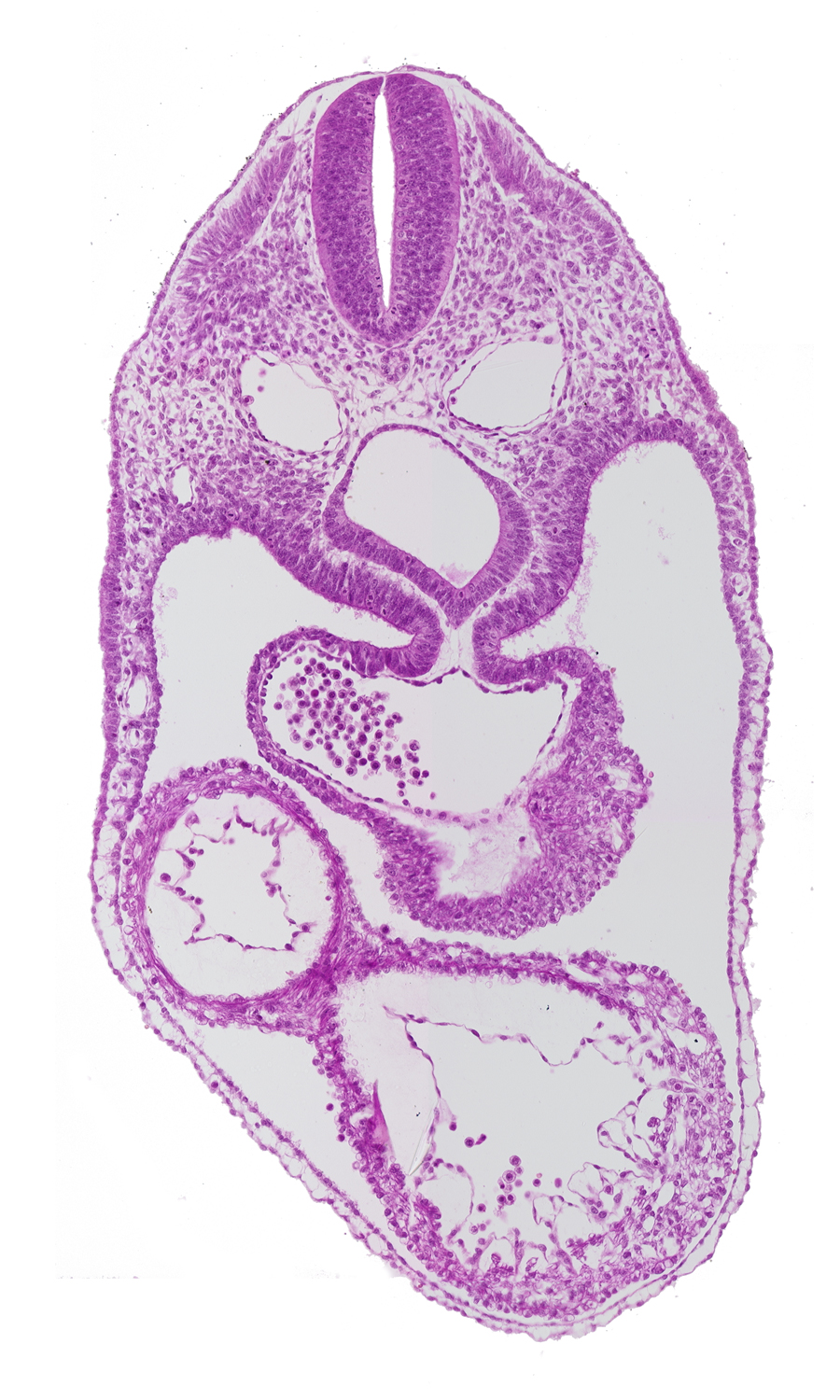 anterior interventricular sulcus, cephalic edge of septum tranversum, dermatomyotome 4 (O-4) , dorsal aorta, foregut, junction of common atrium and sinus venosus, laryngotracheal groove, left ventricle, mesocardium, pericardial cavity, posterior interventricular sulcus, precardinal vein, right ventricle