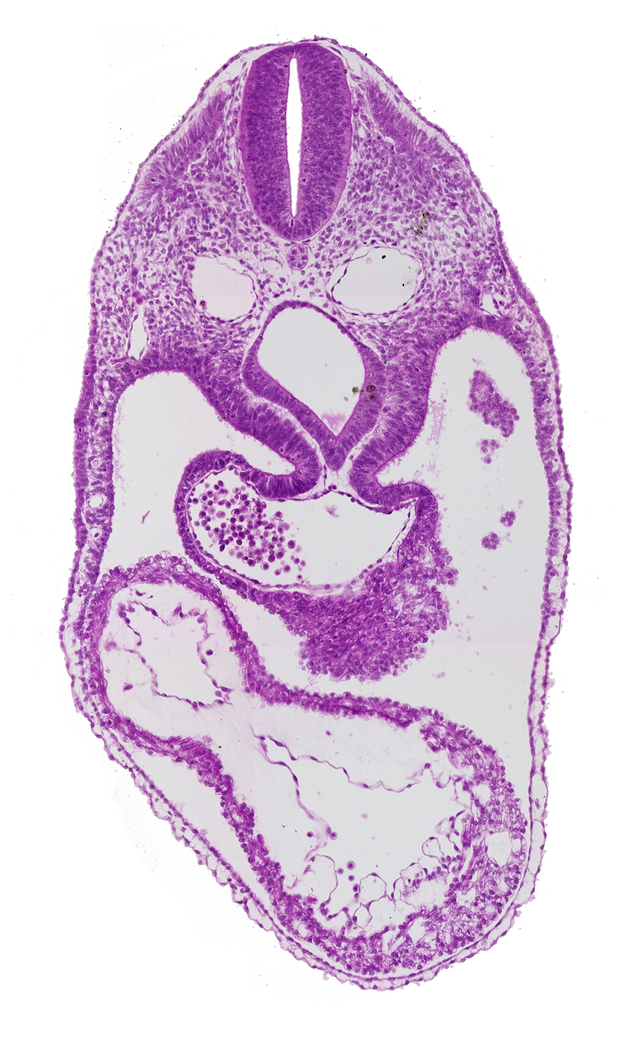 anterior interventricular sulcus, cephalic edge of septum tranversum, dermatomyotome 4 (O-4) , dorsal aorta, foregut, junction of common atrium and sinus venosus, laryngotracheal groove, left ventricle, mesocardium, pericardial cavity, posterior interventricular sulcus, precardinal vein, right ventricle