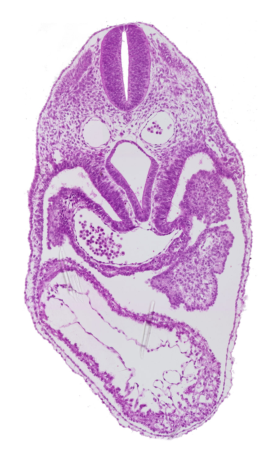 cephalic part of dermatomyotome 5 (C-1), closure area, dorsal aorta, foregut, interventricular foramen, left ventricle, pericardial cavity, pericardioperitoneal canal (pleural cavity), precardinal vein, respiratory primordium, right horn of sinus venosus, right ventricle, sclerotome, septum transversum, spinal cord, sulcus limitans