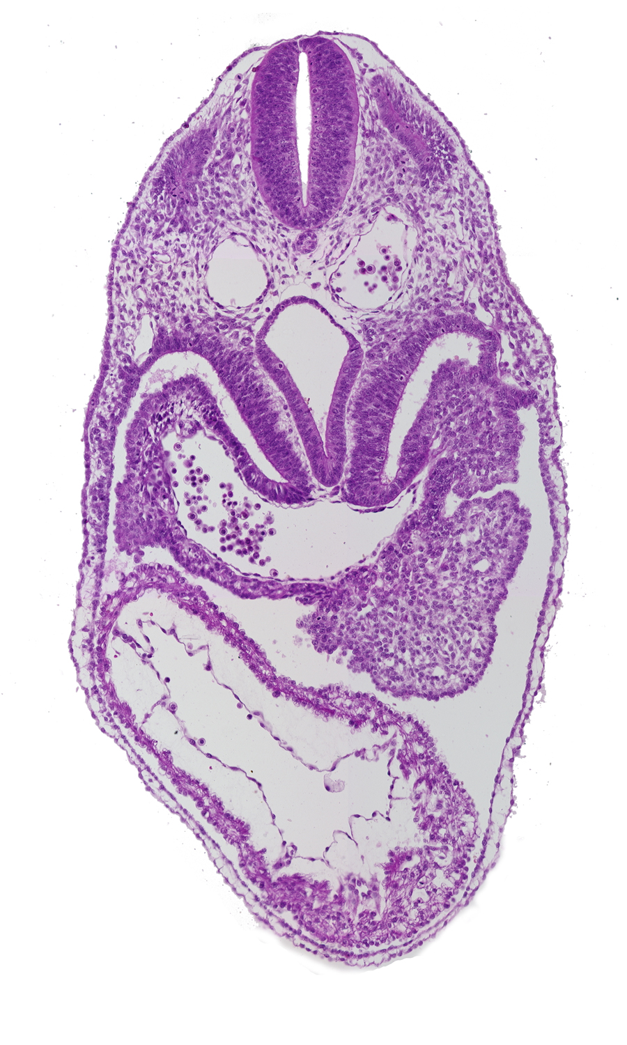 common ventricle, dermatomyotome 5 (C-1), dorsal aorta, foregut, left ventricle, pericardial cavity, pericardial sac, pericardioperitoneal canal (pleural cavity), precardinal vein, respiratory primordium, right horn of sinus venosus, sclerotome, septum transversum, sinus venosus, spinal part of neural tube lumen, surface ectoderm