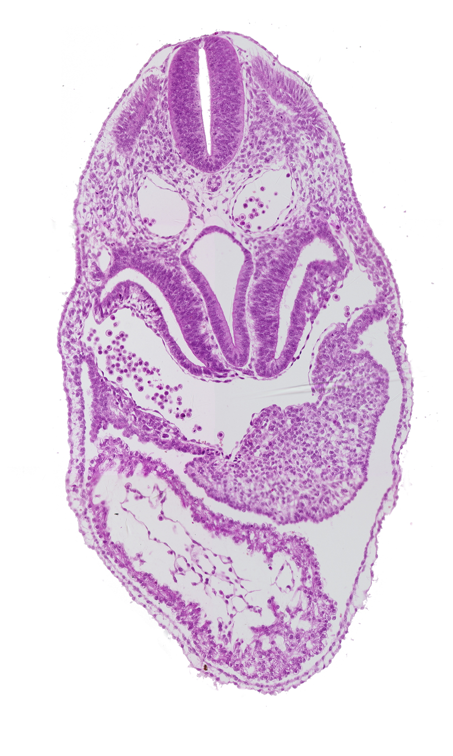 cardiac jelly, common ventricle, dermatomyotome 5 (C-1), dorsal aorta, endocardium, epimyocardium, floor plate, foregut, junction of left sinus horn and postcardinal vein, left horn of sinus venosus, left ventricle, notochord, pericardial cavity, pericardioperitoneal canal (pleural cavity), respiratory primordium, right horn of sinus venosus, right ventricle, roof plate, sclerotome, septum transversum, sinus venosus, somitocoel, spinal cord, sulcus limitans