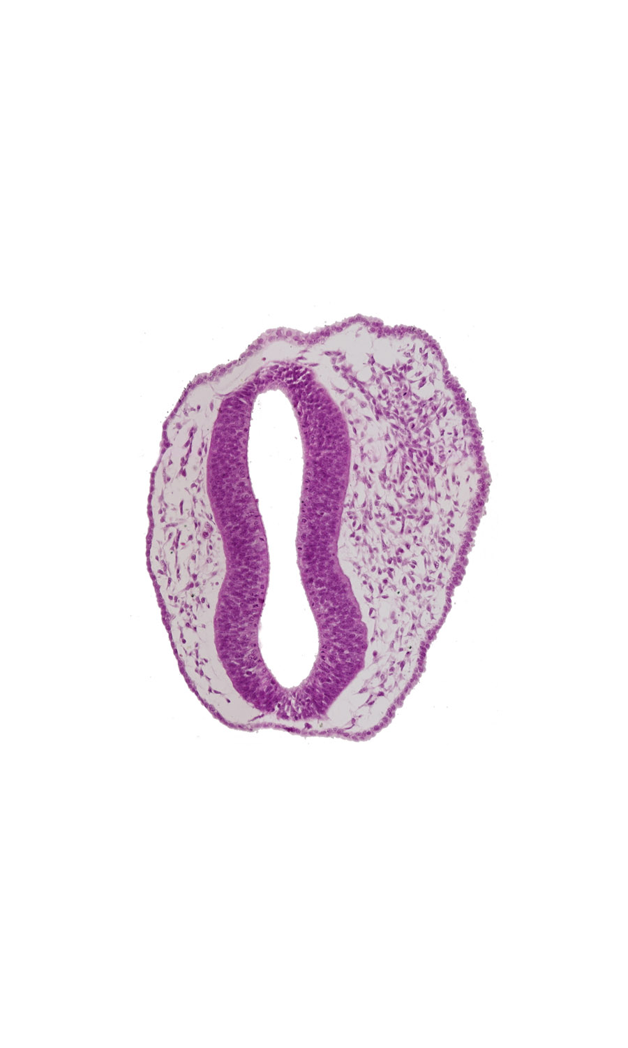 head mesenchyme, mesencephalon (M2), mesencoel, rhombencephalon (Rh. 1), rhombencoel (fourth ventricle), surface ectoderm, trigeminal neural crest (CN V)