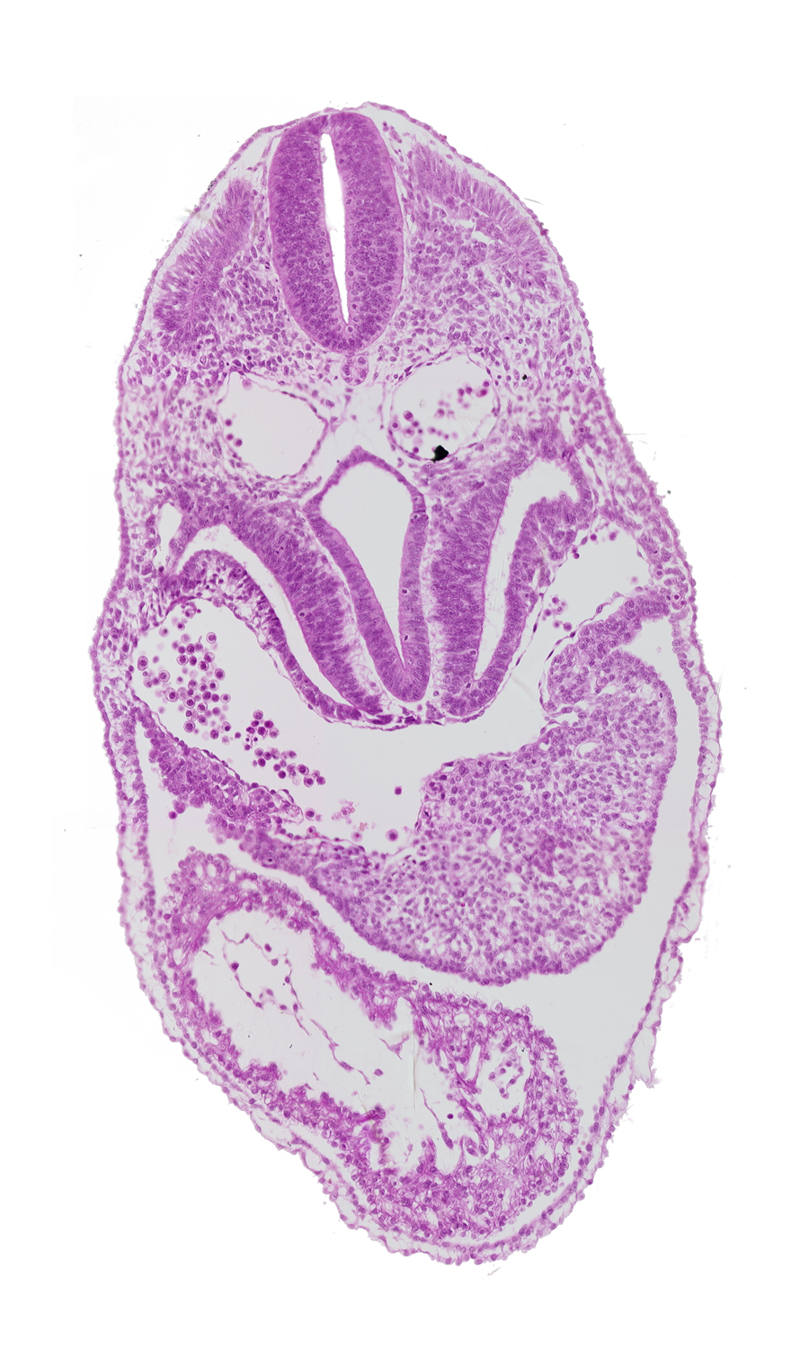 anterior interventricular sulcus, common ventricle, dermatomyotome 5 (C-1), dorsal aorta, floor plate, foregut, left ventricle, pericardial cavity, pericardioperitoneal canal (pleural cavity), postcardinal vein, respiratory primordium, right ventricle, roof plate, sclerotome, septum transversum, sinus venosus, sulcus limitans