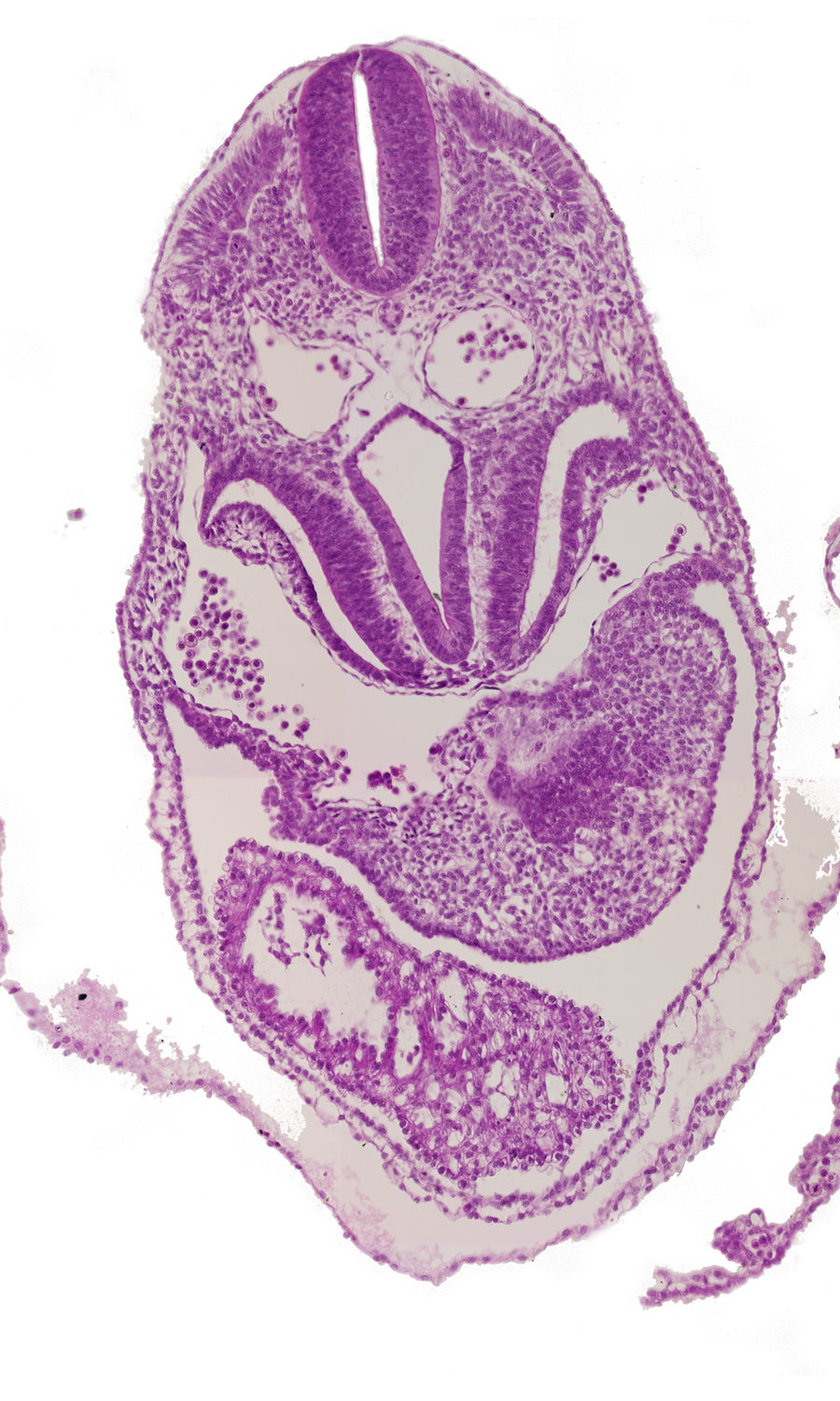 caudal edge of respiratory primordium, caudal part of ventricles, cephalic wall of hepatic antrum, dermatomyotome 5 (C-1), foregut, junction of right horn of sinus venosus and right postcardinal vein, left horn of sinus venosus, pericardial cavity, pericardioperitoneal canal (pleural cavity), postcardinal vein, right horn of sinus venosus, sclerotome, septum transversum, ventral body wall