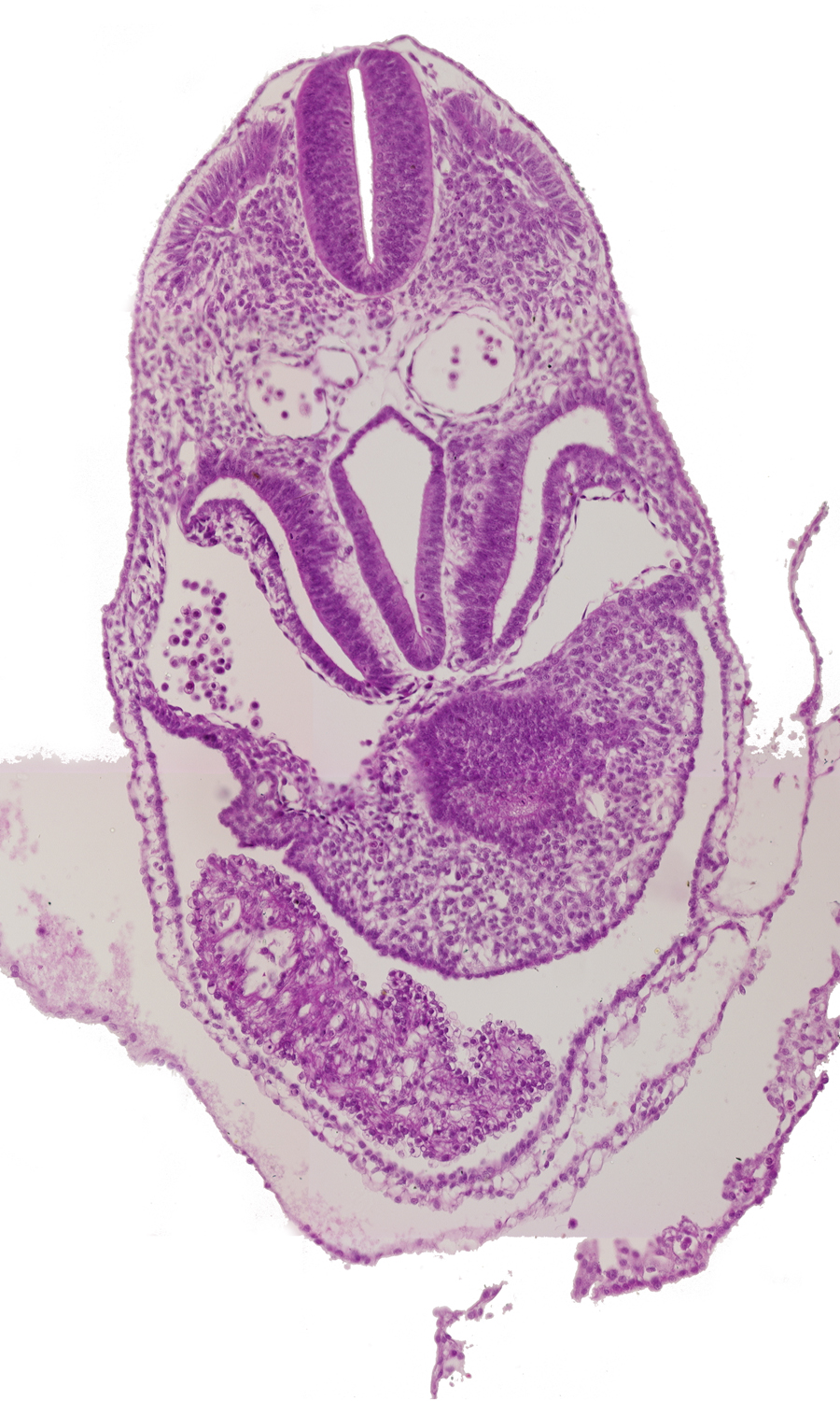 amnion, caudal edge of respiratory primordium, caudal part of ventricles, cephalic wall of hepatic antrum, dermatomyotome 5 (C-1), foregut, junction of right horn of sinus venosus and right postcardinal vein, pericardial cavity, pericardioperitoneal canal (pleural cavity), postcardinal vein, right horn of sinus venosus, sclerotome, septum transversum, ventral body wall