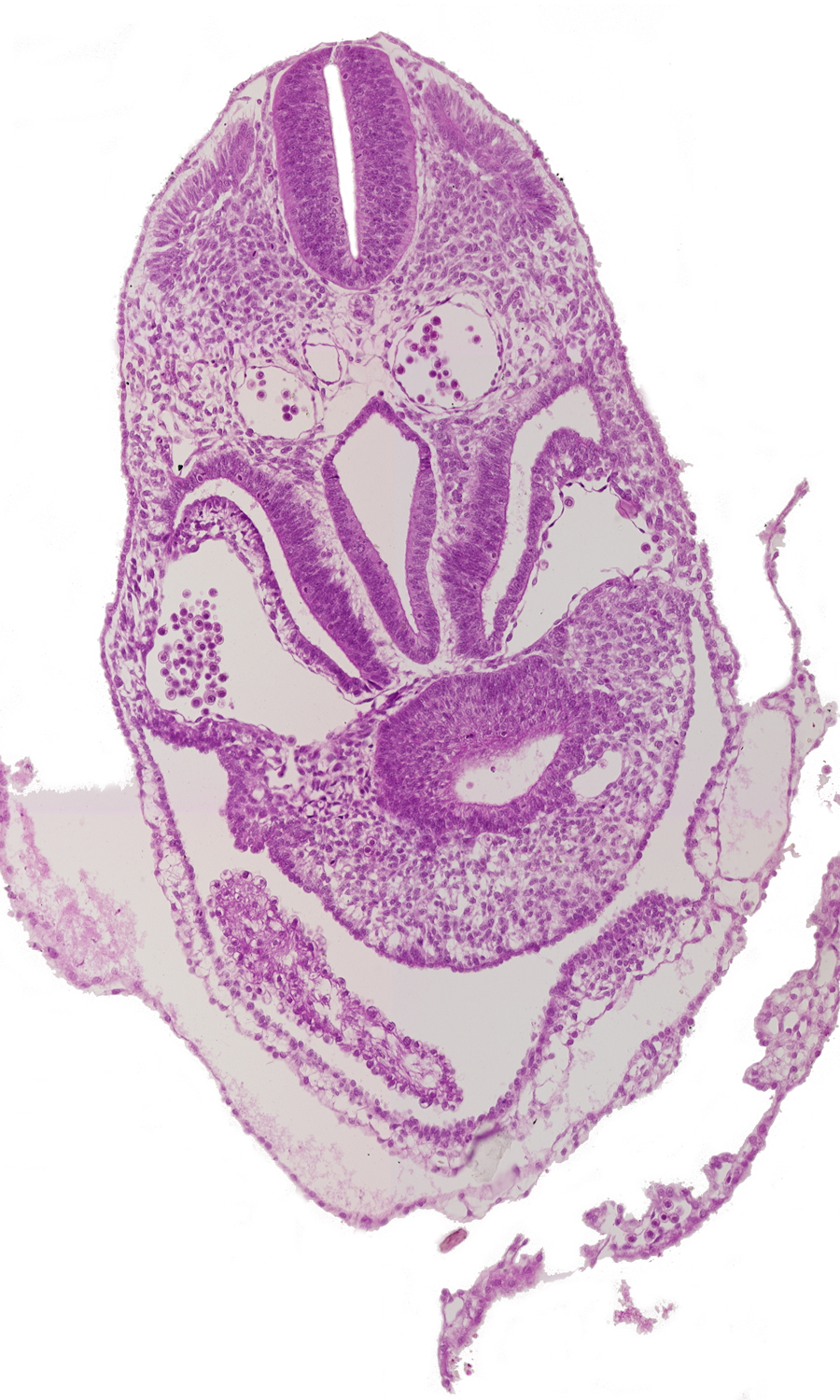 amnion, amnion attachment to ventral body wall (caudal part of head fold), amniotic cavity, caudal edge of ventricles, dermatomyotome 5 (C-1), foregut, hepatic antrum, left horn of sinus venosus, pericardial cavity, postcardinal vein, right horn of sinus venosus, septum transversum