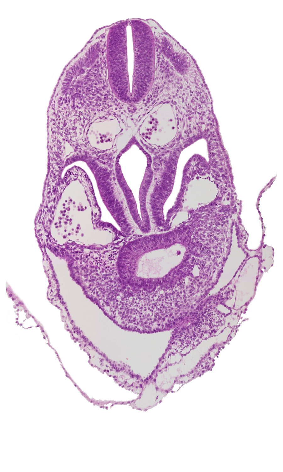 amnion, amniotic cavity, dermatomyotome 5-6 interspace, hepatic antrum, junction of amnion and ventral body wall (caudal part of head), pericardial cavity, pericardioperitoneal canal (pleural cavity), postcardinal vein, septum transversum