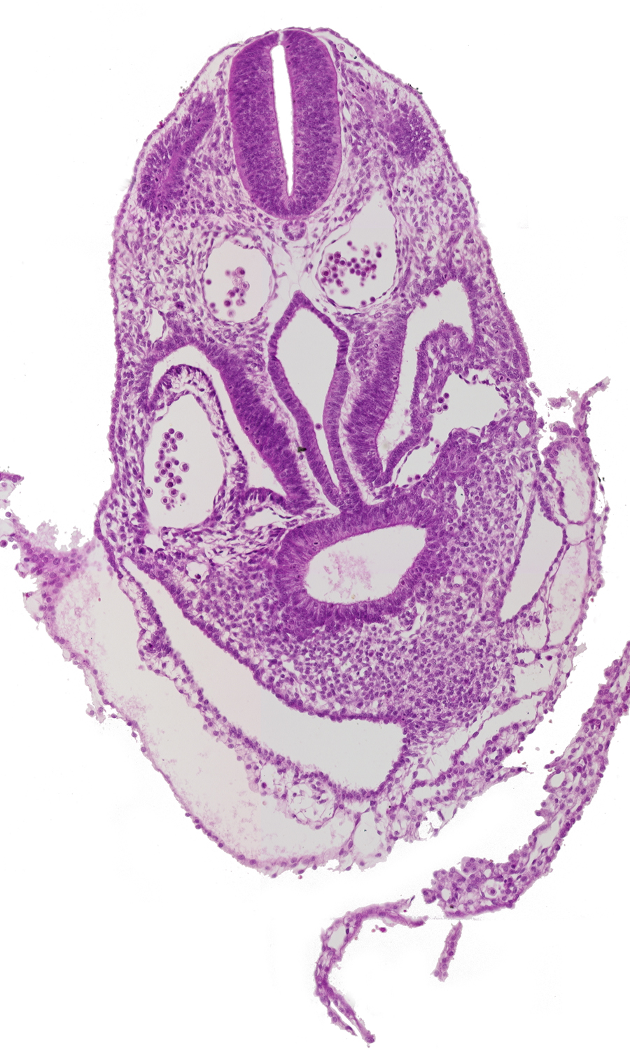 amnion, amniotic cavity, caudal part of pericardioperitoneal canal (pleural cavity), dermatomyotome 6 (C-2), extra-embryonic coelom, hepatic antrum, hepatic diverticulum, junction of amnion and umbilical vesicle, junction of foregut and midgut, junction of left horn of sinus venosus and left umbilical vein, pericardial cavity, postcardinal vein, right horn of sinus venosus, umbilical vesicle wall, ventral body wall