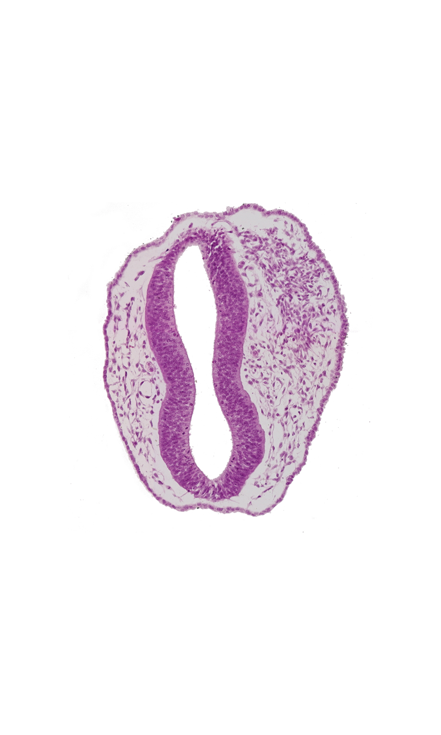 blood vessel(s), head mesenchyme, mesencephalon (M2), mesencoel, rhombencephalon (Rh. 1), rhombencoel (fourth ventricle), sulcus limitans, surface ectoderm, trigeminal neural crest (CN V)