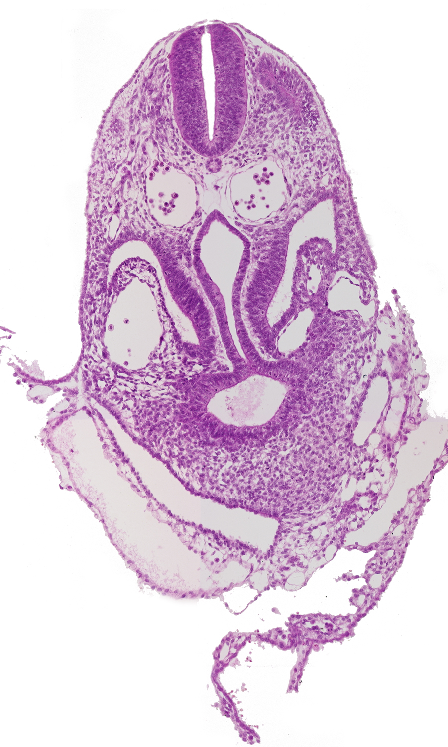 amnion, amnion attachment, amniotic cavity, caudal part of pericardioperitoneal canal (pleural cavity), dermatomyotome 6 (C-2), extra-embryonic coelom, hepatic antrum, hepatic diverticulum, junction of amnion and umbilical vesicle, junction of left horn of sinus venosus and left umbilical vein, pericardial cavity, postcardinal vein, sclerotome, ventral body wall