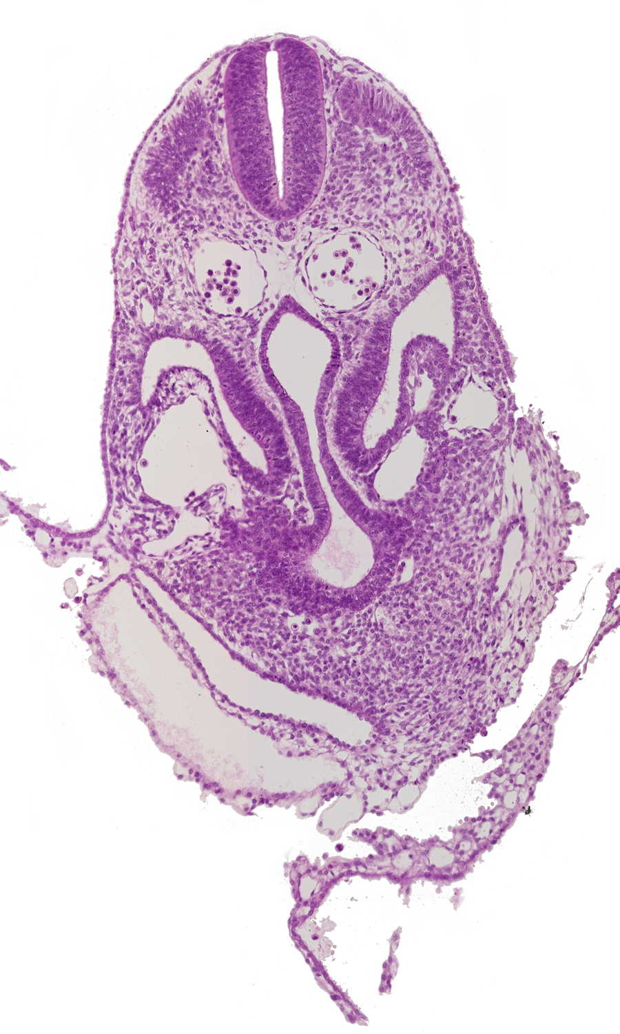 amnion, amniotic cavity, dermatomyotome 6 (C-2), dorsal aorta, hepatic antrum, junction of left horn of sinus venosus and left umbilical vein, left umbilical vein, midgut, pericardial cavity, peritoneal cavity, postcardinal vein, right horn of sinus venosus, umbilical vesicle wall, ventral body wall