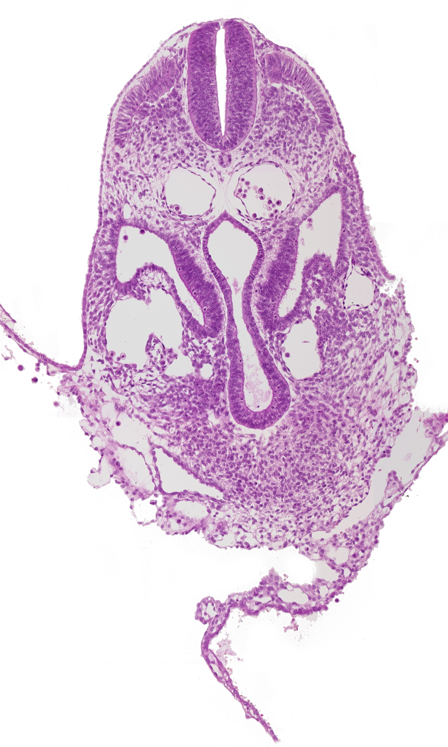 amnion, amniotic cavity, caudal part of pericardial cavity, dermatomyotome 6 (C-2), hemopoietic tissue, hepatic venous plexus, left umbilical vein, left vitelline (omphalomesenteric) vein, midgut, postcardinal vein, right horn of sinus venosus, sclerotome, umbilical vesicle wall