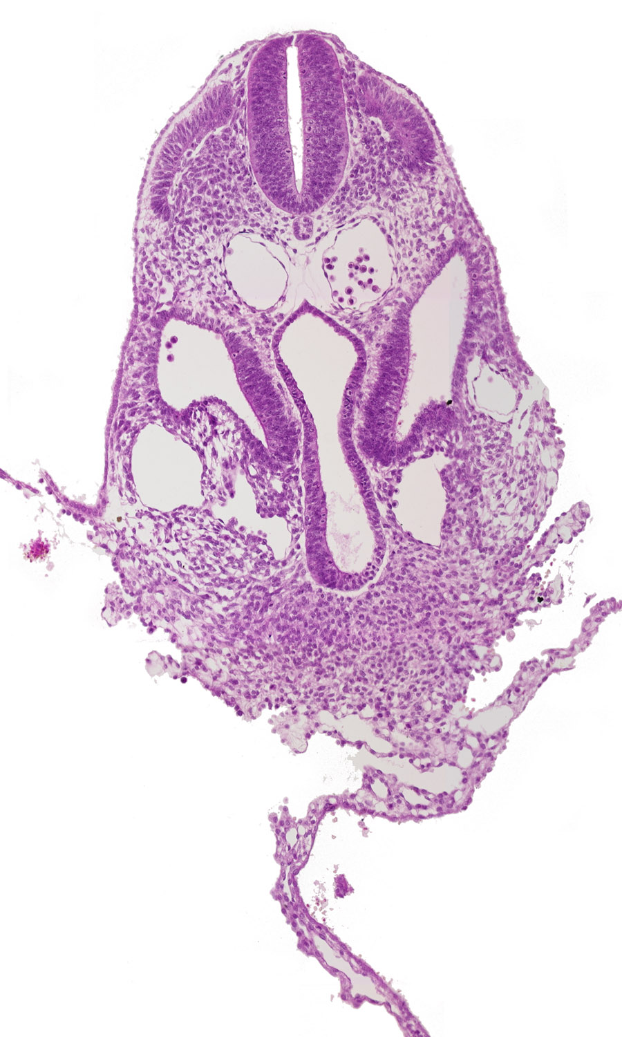 alar plate(s), amnion attachment, basal plate, dermatomyotome 6 (C-2), dorsal aorta, floor plate, junction of septum transversum and umbilical vesicle, mesothelium of umbilical vesicle, peritoneal cavity, right umbilical vein, roof plate, sclerotome, septum transversum, sulcus limitans, umbilical vesicle wall