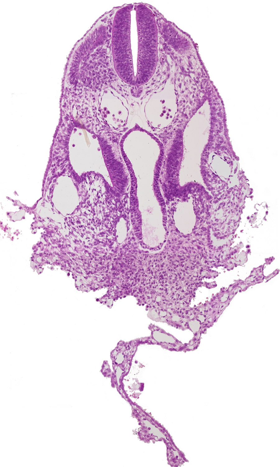 caudal edge of dermatomyotome 6 (C-2), dorsal aorta, junction of septum transversum and umbilical vesicle, left vitelline (omphalomesenteric) vein, midgut, notochord, origin of dorsal intersegmental artery, peritoneal cavity, septum transversum, specialized coelomic wall, umbilical vesicle wall