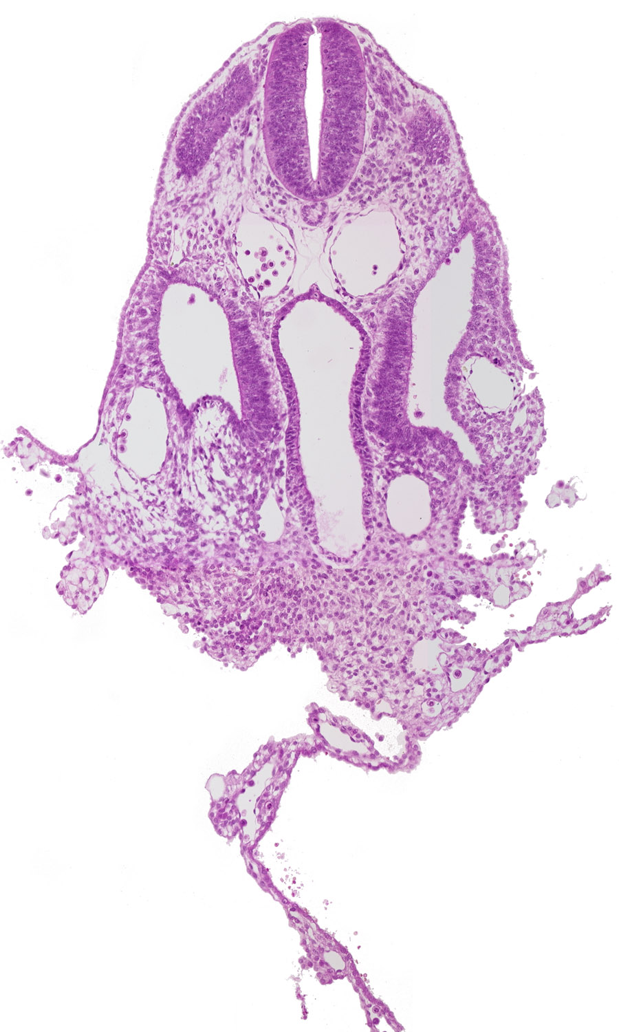 amnion attachment, dermatomyotome 7 (C-3), dorsal aorta, extra-embryonic coelom, left umbilical vein, mesothelium of umbilical vesicle, midgut, notochord, right umbilical vein, septum transversum, splanchnopleuric mesoderm, umbilical vesicle wall