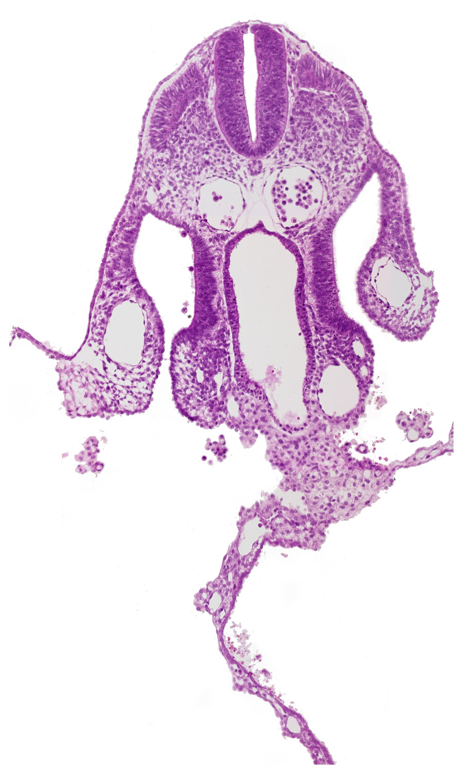 caudal edge of septum transversum, dermatomyotome 7 (C-3), left vitelline (omphalomesenteric) vein, mesothelium of umbilical vesicle, midgut, peritoneal cavity, right vitelline (omphalomesenteric) vein, somatopleuric mesoderm, spinal part of neural tube, splanchnopleuric mesoderm, surface ectoderm, umbilical vesicle wall
