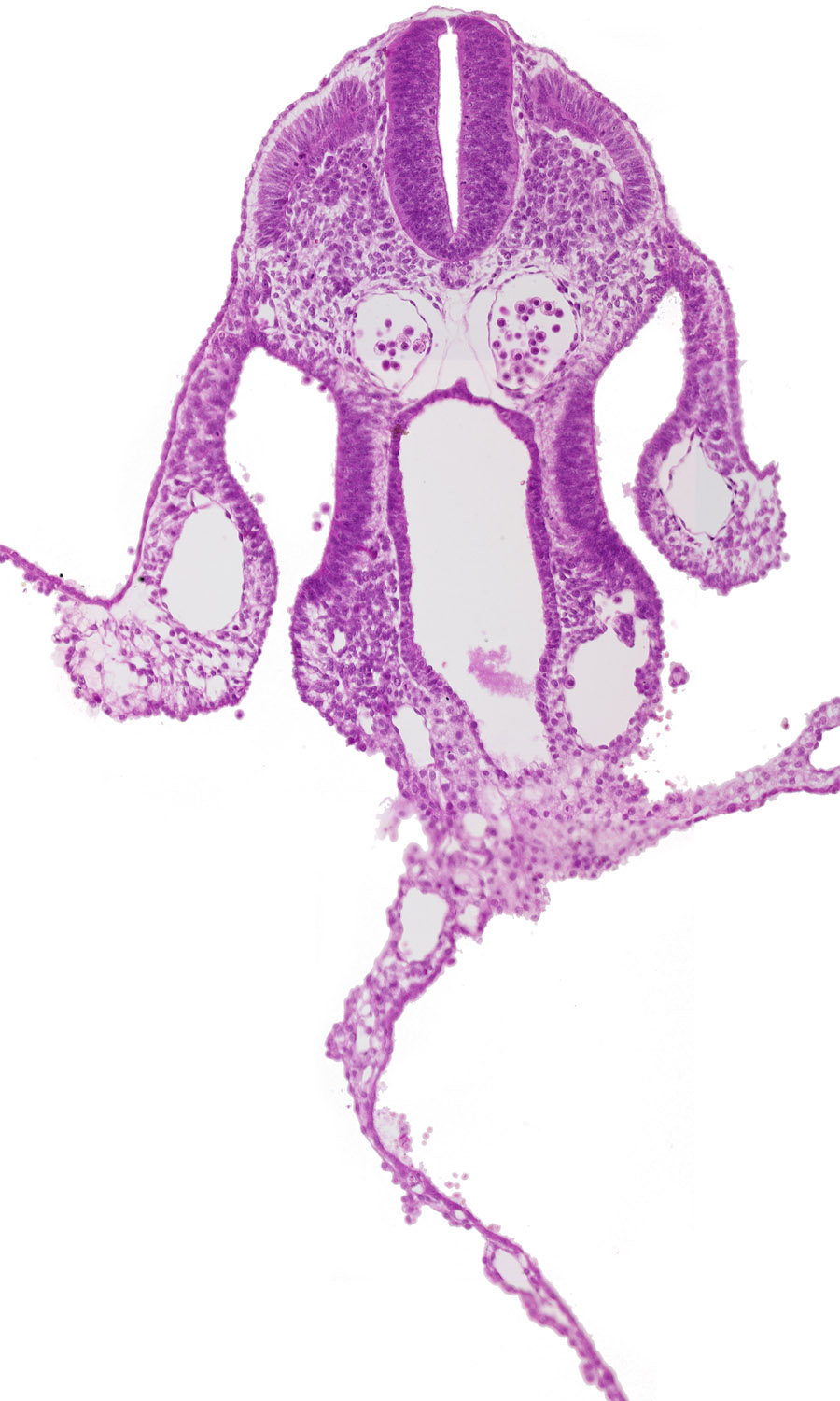 amnion, amniotic cavity, cephalic intestinal portal, dermatomyotome 7 (C-3), dorsal aorta, junction of midgut and umbilical vesicle wall, left umbilical vein, left vitelline (omphalomesenteric) vein, midgut, nucleated red blood cells, peritoneal cavity, right umbilical vein, right vitelline (omphalomesenteric) vein, umbilical vesicle cavity