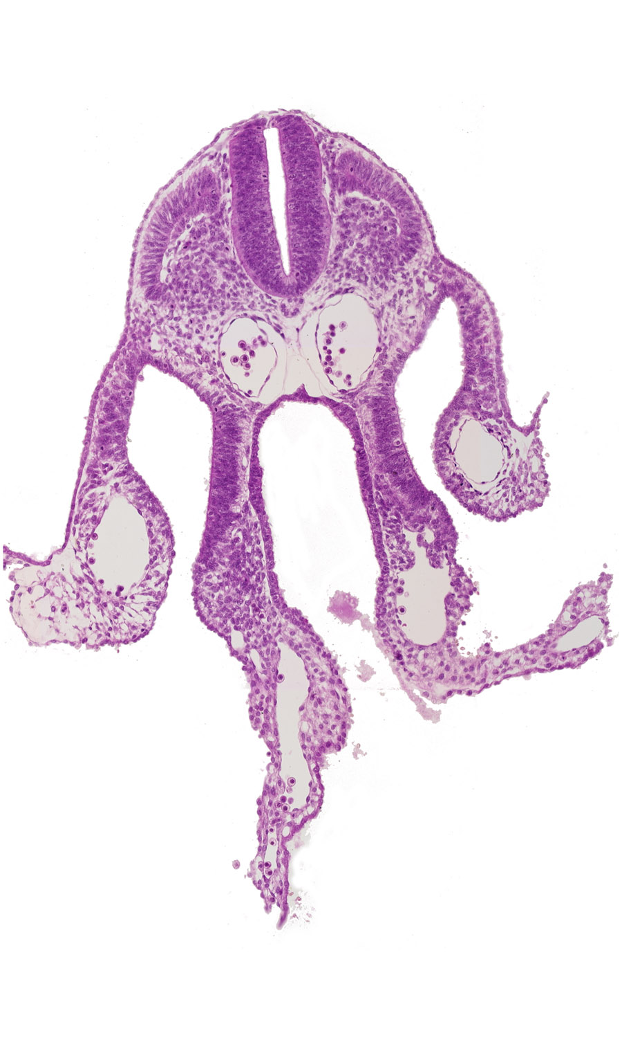 amnion, amnion attachment, amniotic cavity, cephalic intestinal portal, dermatomyotome 7 (C-3), dorsal aorta, left umbilical vein, left vitelline (omphalomesenteric) vein, nucleated red blood cells, peritoneal cavity, right umbilical vein, right vitelline (omphalomesenteric) vein, umbilical vesicle cavity