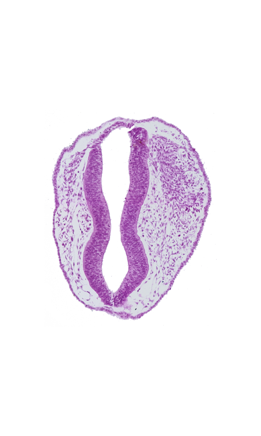 artifact separation(s), blood vessel(s), mesencephalon (M2), mesencoel, rhombencephalon (Rh. 1), rhombencephalon (Rh. 2), rhombencoel (fourth ventricle), roof plate, surface ectoderm, trigeminal neural crest (CN V)