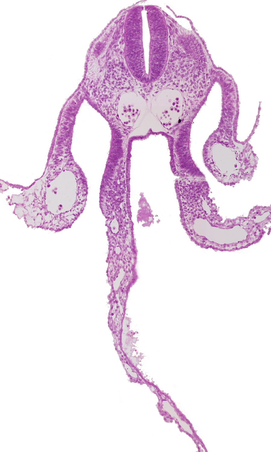 alar plate(s), basal plate, communication between peritoneal cavity and extra-embryonic coelom, dermatomyotome 8 (C-4), dorsal aorta, floor plate, left vitelline (omphalomesenteric) vein, midgut, neural tube, notochord, peritoneal cavity, roof plate, specialized coelomic wall, sulcus limitans