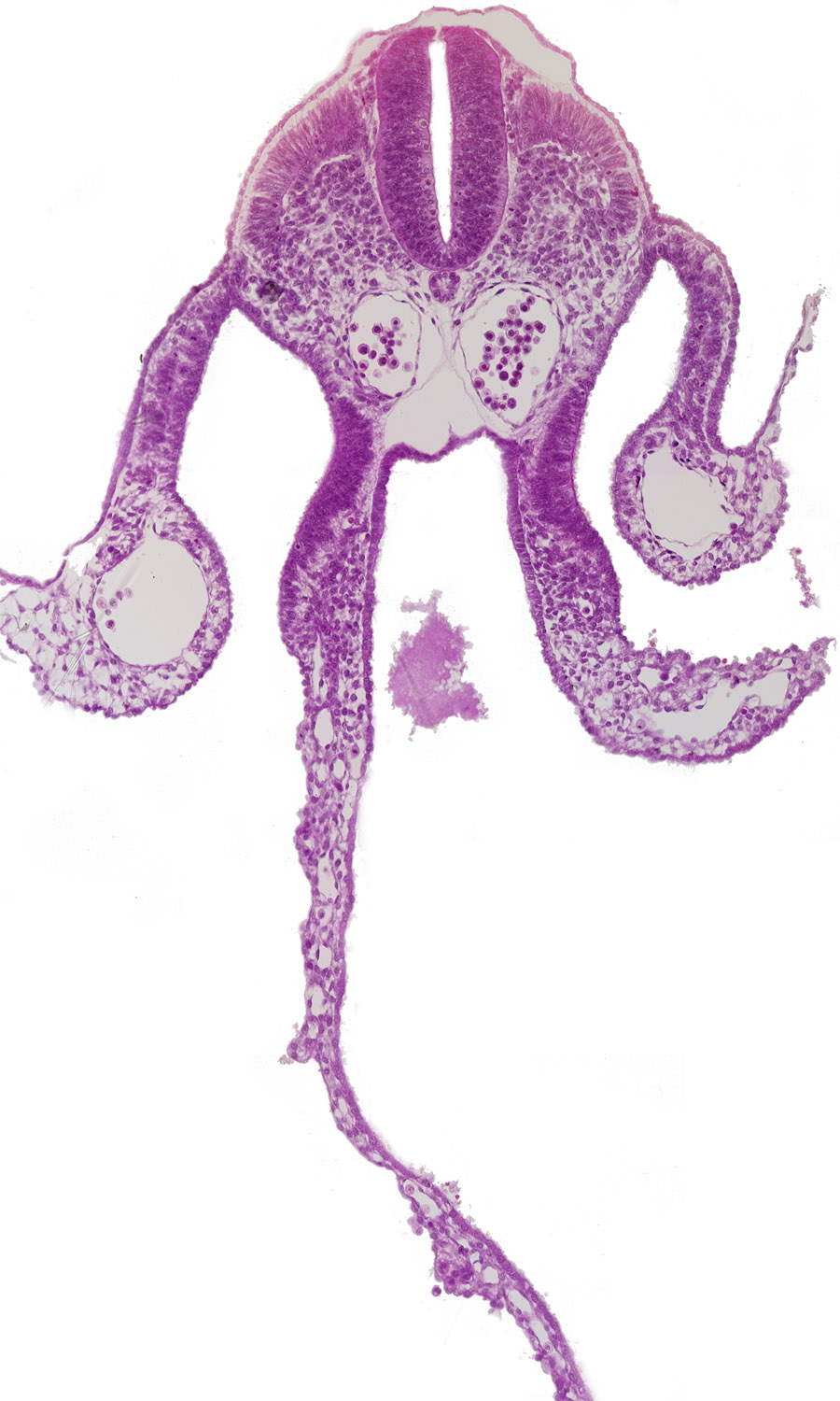 artifact space(s), dermatomyotome 8 (C-4), dorsal aorta, left vitelline (omphalomesenteric) vein, midgut, notochord, peritoneal cavity, right vitelline (omphalomesenteric) vein, sclerotome, somatopleuric mesoderm, splanchnopleuric mesoderm