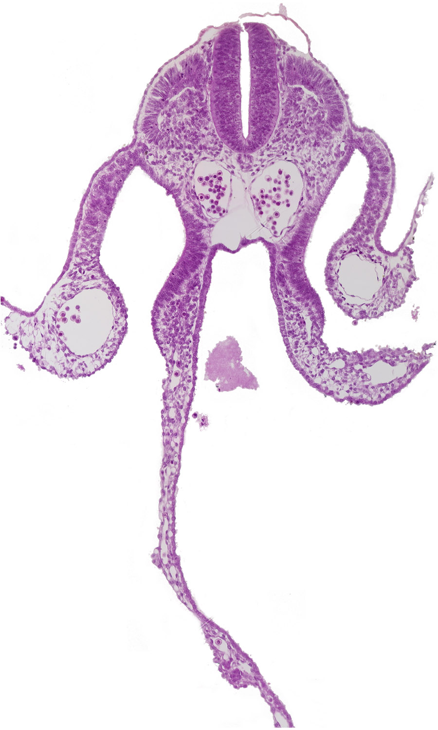 amnion attachment, amniotic cavity, communication between peritoneal cavity and extra-embryonic coelom, dermatomyotome 8 (C-4), dorsal aorta, midgut, right umbilical vein, somitocoel