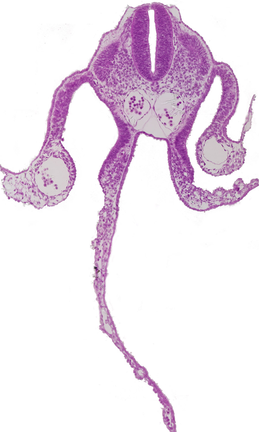 alar plate(s), amnion attachment, amniotic cavity, basal plate, cephalic edge of presumptive upper limb bud, dermatomyotome 9 (C-5), floor plate, midgut, notochord, roof plate, sclerotome, sulcus limitans, umbilical vesicle cavity