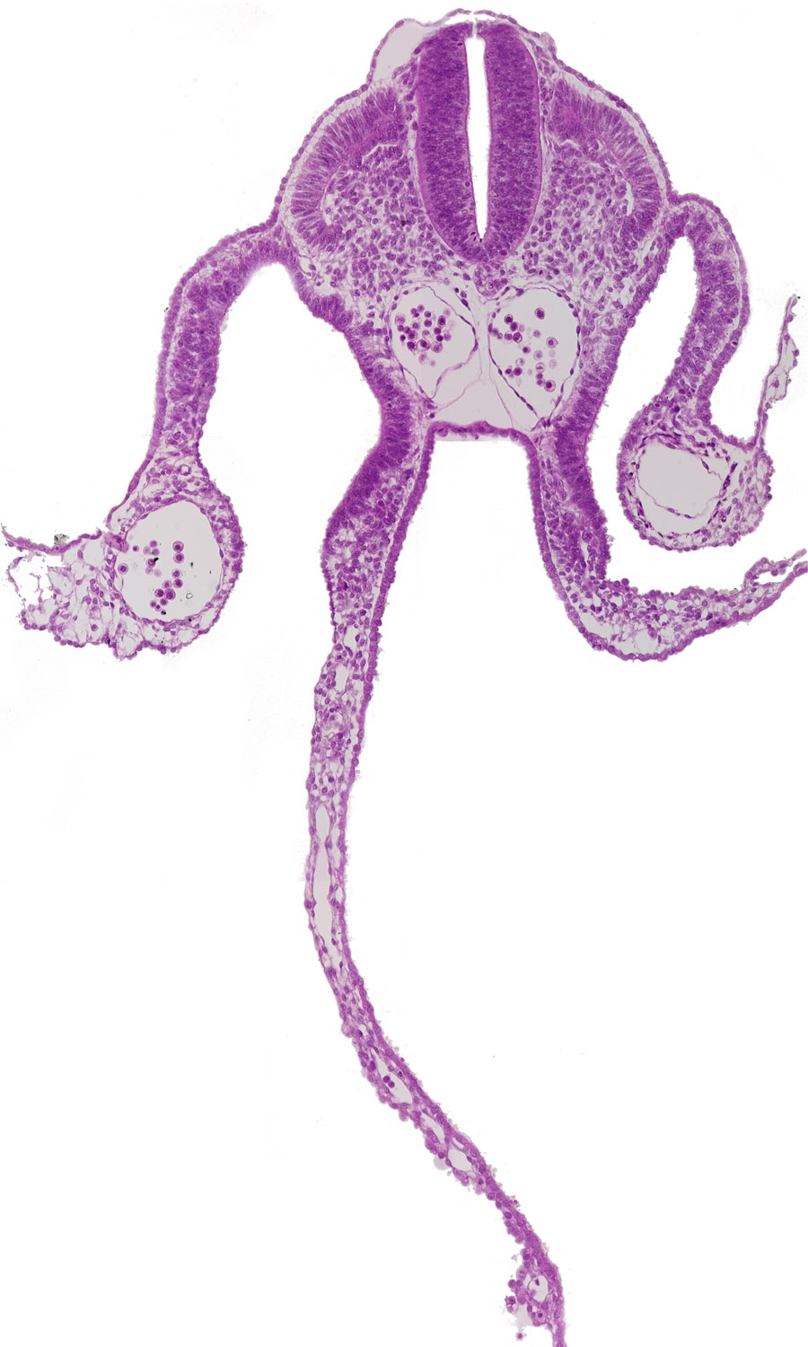 amnion attachment, dermatomyotome 9 (C-5), left umbilical vein, midgut, peritoneal cavity, presumptive upper limb bud, primordial omental bursa, right umbilical vein, somatopleure, splanchnopleure, surface ectoderm