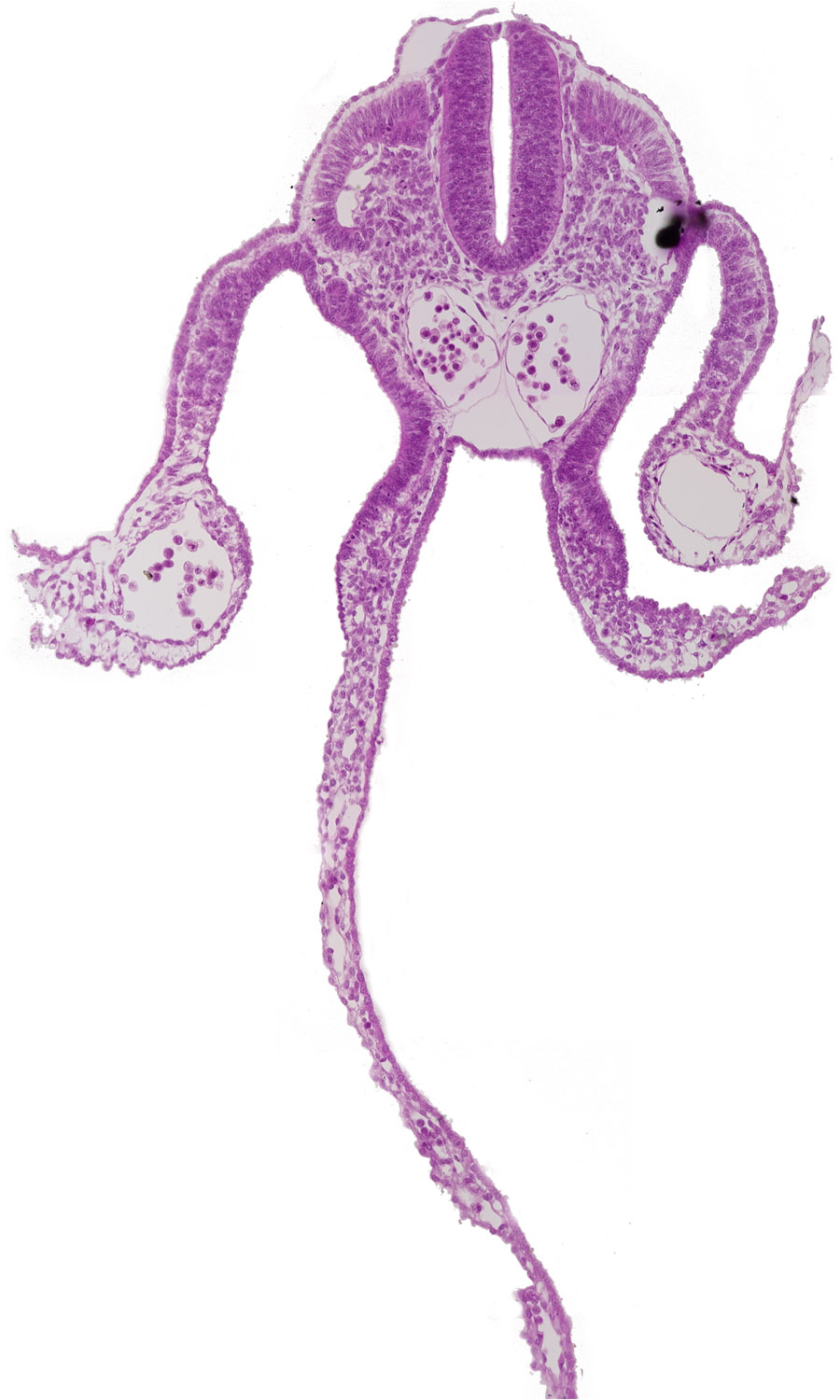 amnion attachment, amniotic cavity, cephalic extent of mesonephric vesicles, dermatomyotome 9 (C-5), left umbilical vein, midgut, perinotochordal lamina, peritoneal cavity, right umbilical vein, sclerotome, umbilical vesicle cavity