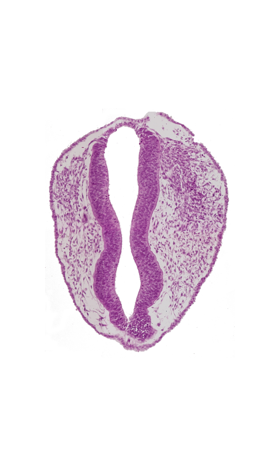 mesencephalon (M2), mesencoel, rhombencephalon (Rh. 1), rhombencephalon (Rh. 2), rhombencoel (fourth ventricle), roof plate, surface ectoderm, trigeminal neural crest (CN V)