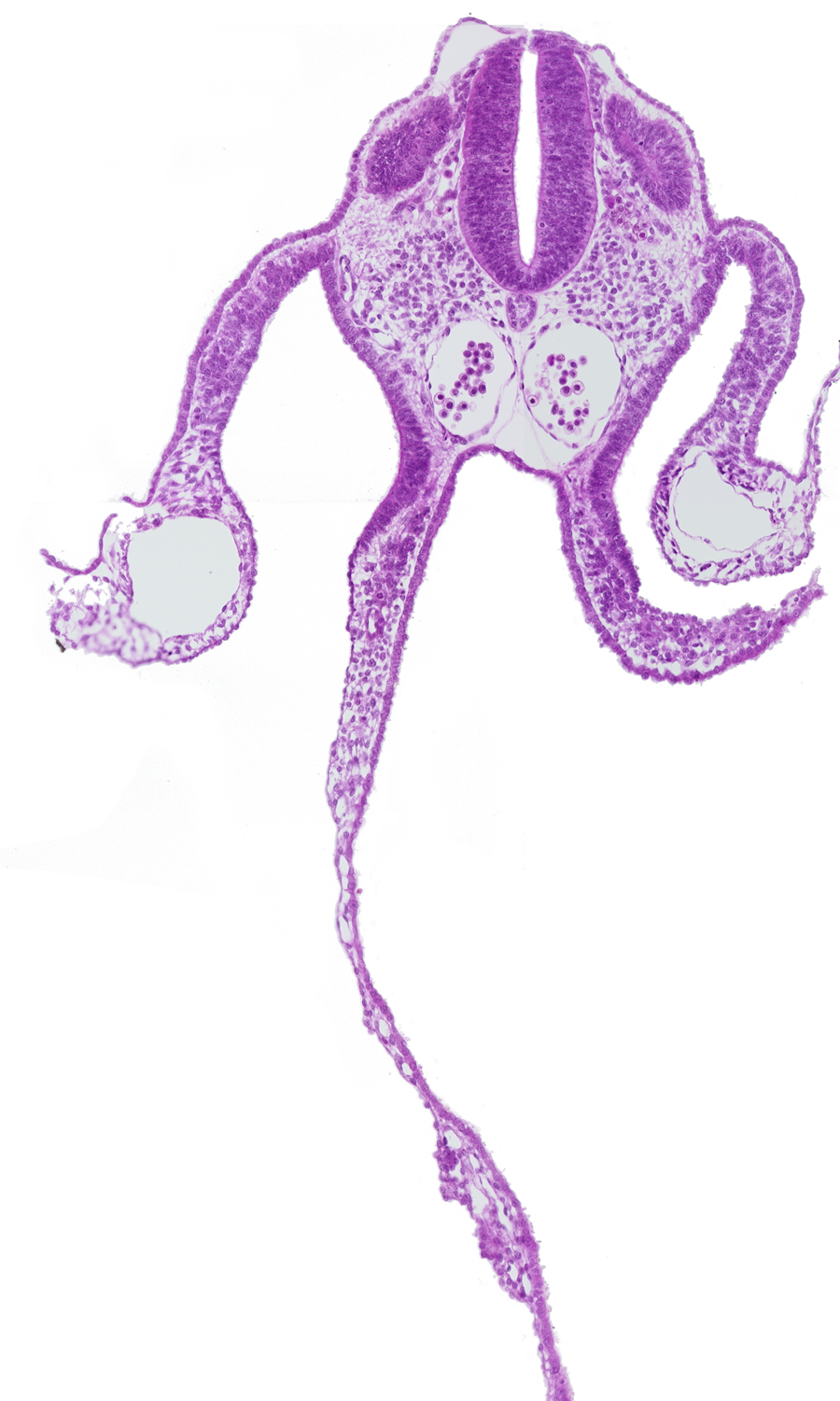 amnion attachment, dermatomyotome 9 (C-5), dorsal aorta, midgut, peritoneal cavity, presumptive upper limb bud, primordial omental bursa, right umbilical vein, somatopleure, splanchnopleure
