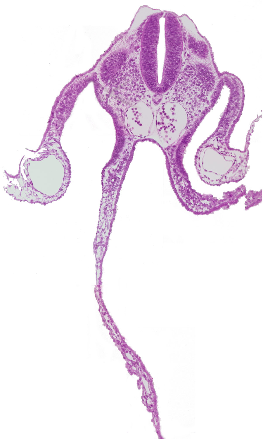 amnion attachment, caudal edge of dermatomyotome 9 (C-5), left umbilical vein, midgut, notochord, peritoneal cavity, primordial omental bursa, right umbilical vein, somatopleure