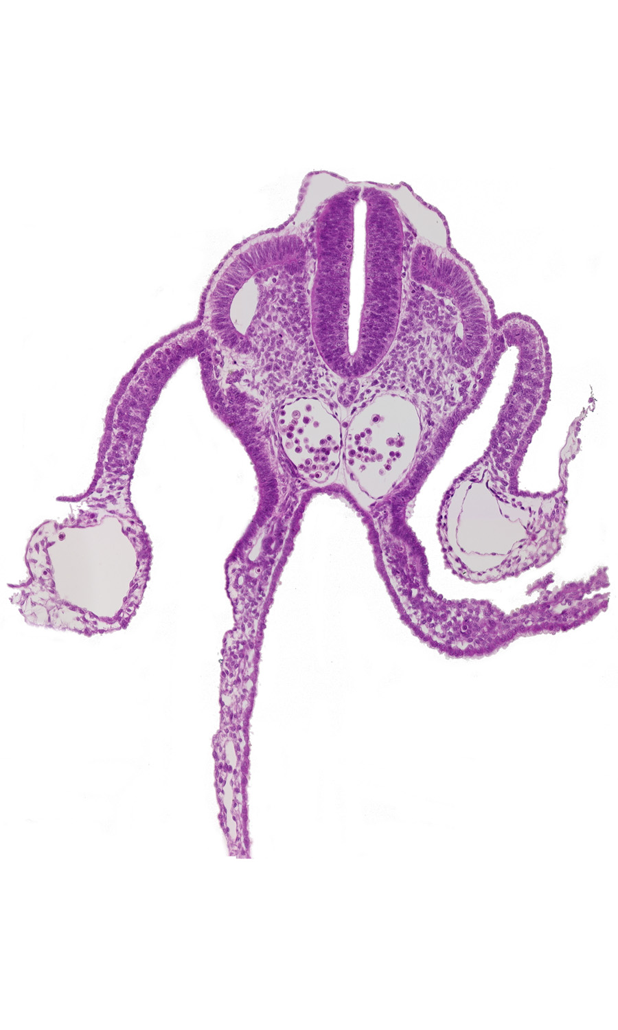 dermatomyotome 10 (C-6), dorsal aorta, left umbilical vein, mesonephric vesicle(s), midgut, peritoneal cavity, presumptive upper limb bud, right umbilical vein, sclerotome