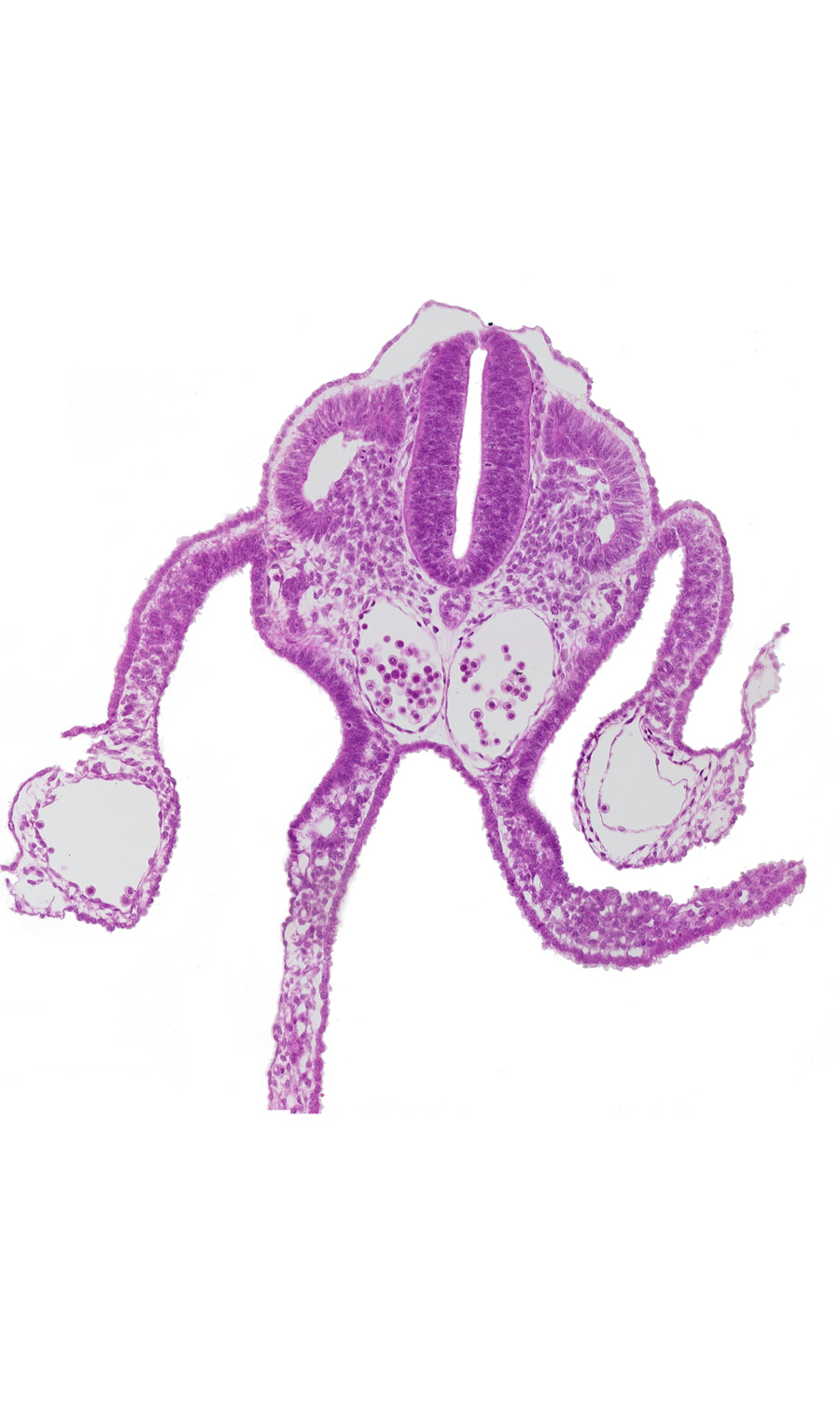 alar plate(s), basal plate, dermatomyotome 10 (C-6), floor plate, lumen of neural tube, notochord, primordial omental bursa, roof plate, separation artifact, sulcus limitans