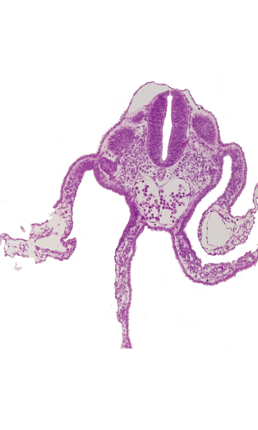 artifact separation(s), caudal edge of dermatomyotome 10 (C-6), communication between dorsal aortas, left umbilical vein, lumen of neural tube, mesonephric vesicle(s), midgut, peritoneal cavity, presumptive upper limb bud, primordial omental bursa