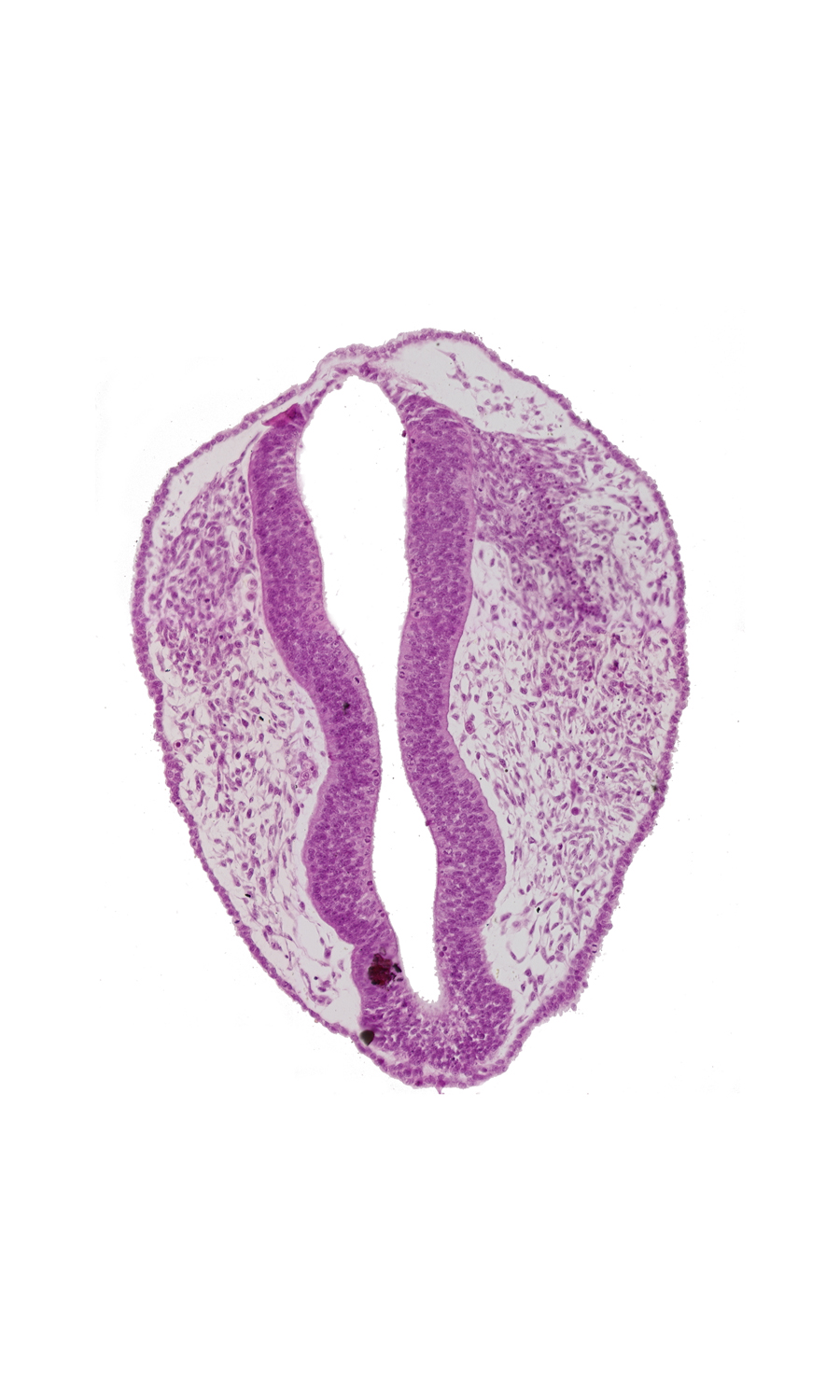 blood vessel(s), ectoderm, head mesenchyme, mesencephalon (M1), mesencephalon (M2), mesencoel, rhombencephalon (Rh. 1), rhombencephalon (Rh. 2), rhombencoel (fourth ventricle), roof plate, trigeminal neural crest (CN V)