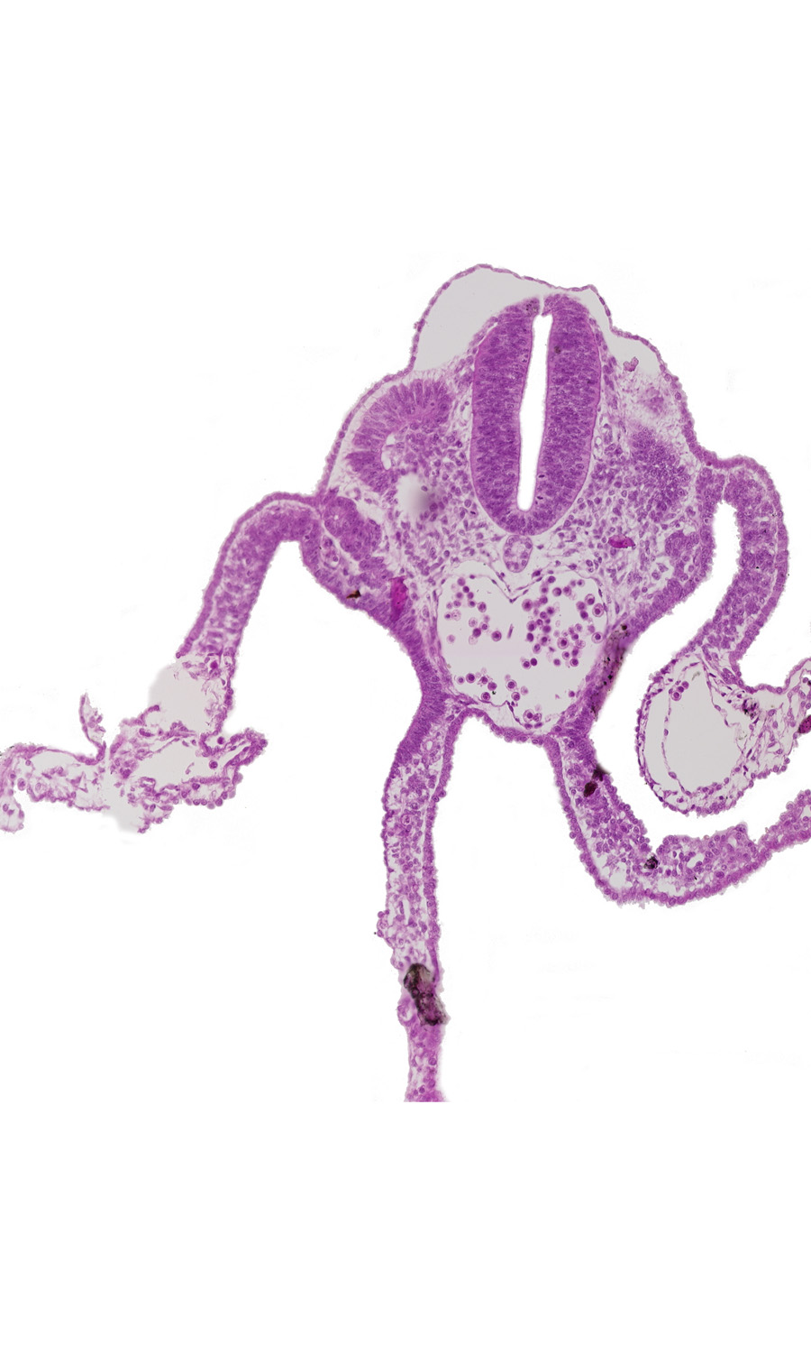 amnion attachment, amniotic cavity, dermatomyotome 11 (C-7), dorsal aorta, mesonephric vesicle(s), midgut, neural tube, peritoneal cavity, primordial omental bursa, umbilical vesicle cavity