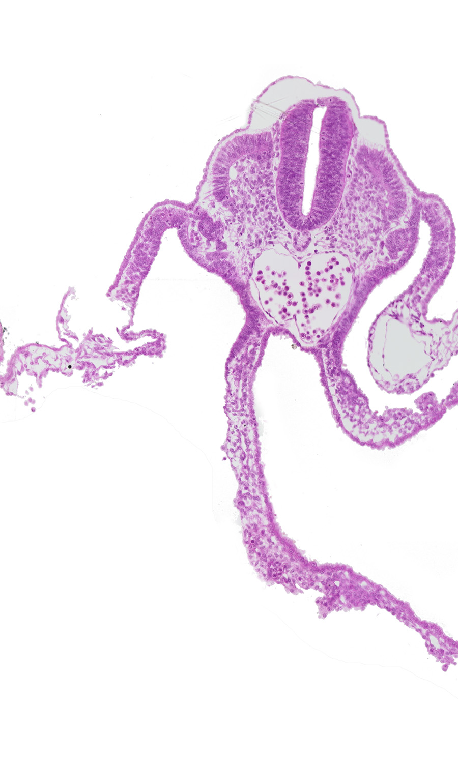 amnion attachment, amniotic cavity, artifact separation(s), dermatomyotome 11 (C-7), left umbilical vein, mesonephric vesicle(s), midgut, peritoneal cavity