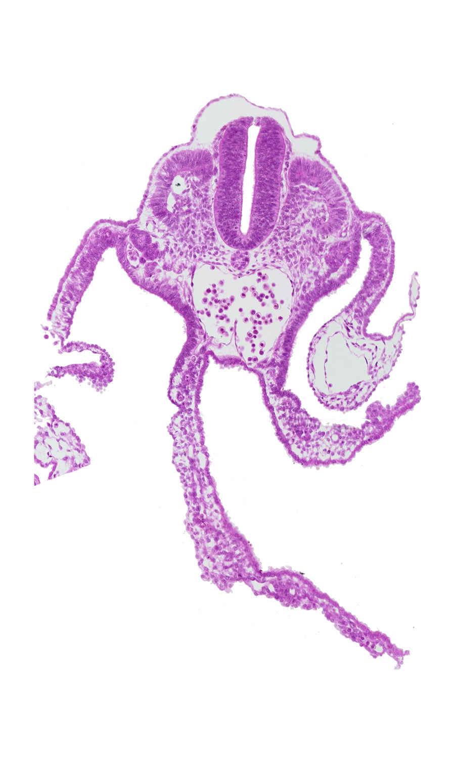 dermatomyotome 11 (C-7), junction of dorsal aortas, mesonephric duct, mesonephric vesicle(s), presumptive upper limb bud, primordial omental bursa